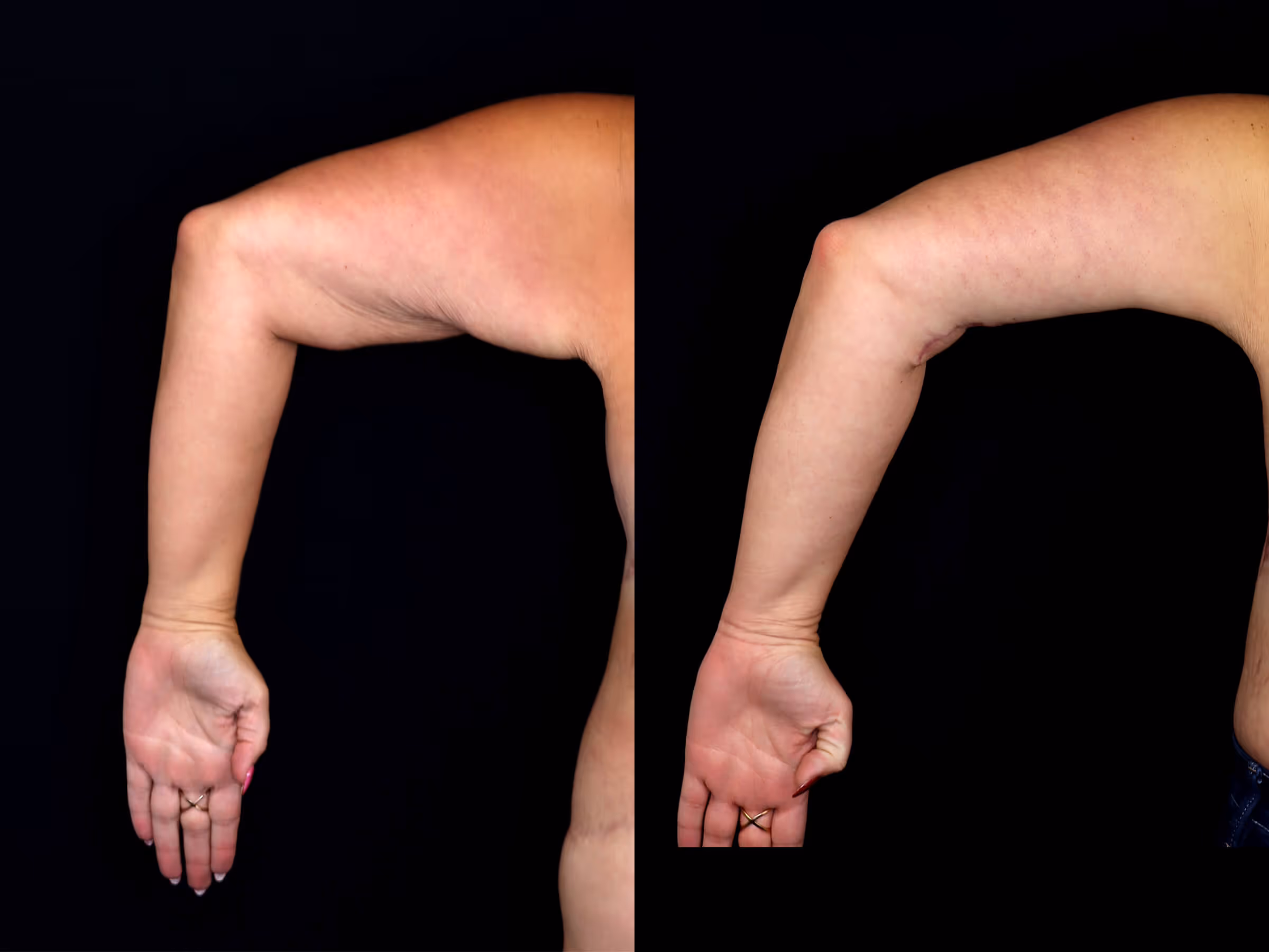 Before And After Patient Image