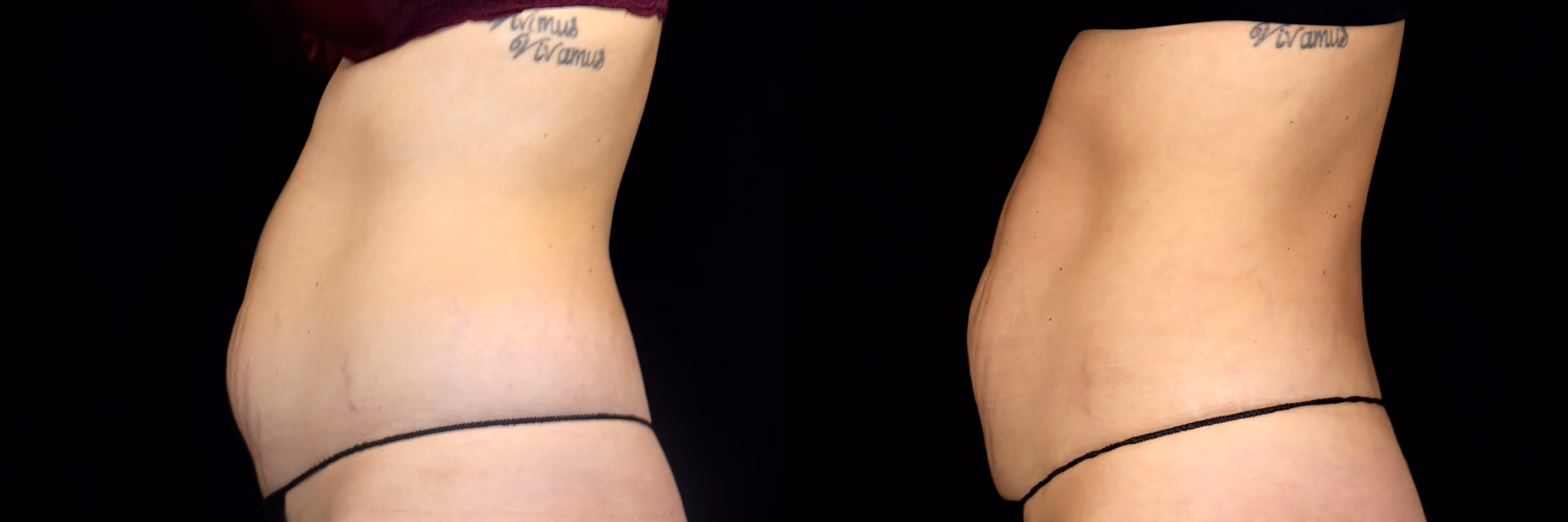 Before And After Patient Image