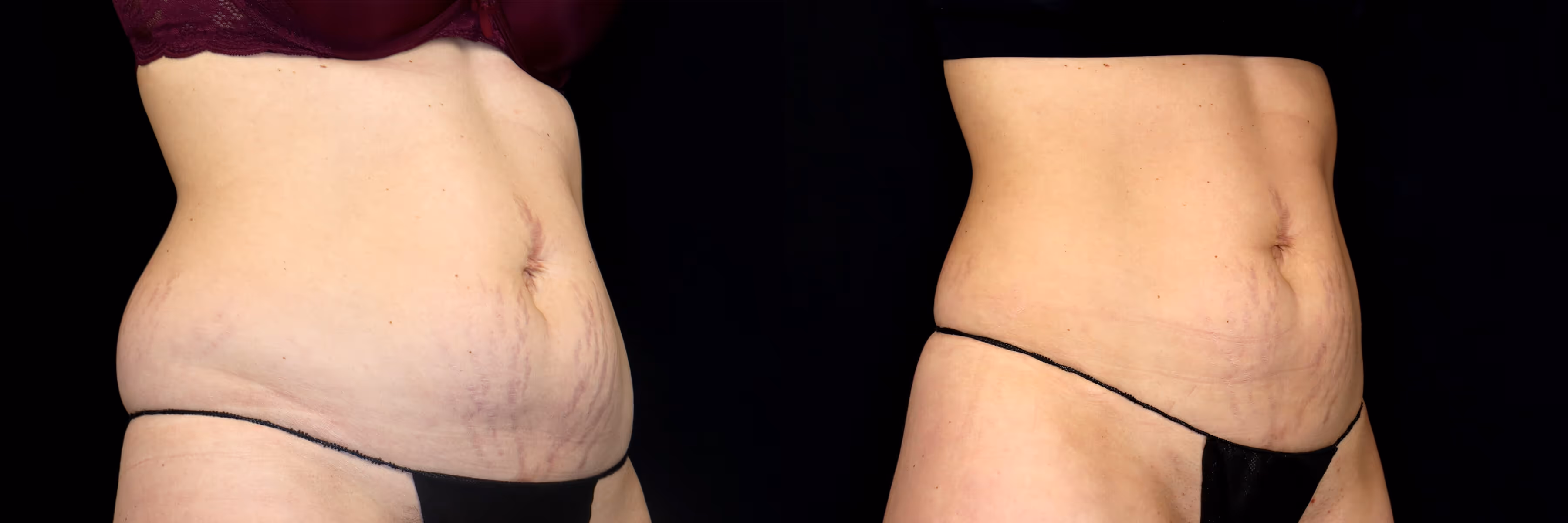 Before And After Patient Image
