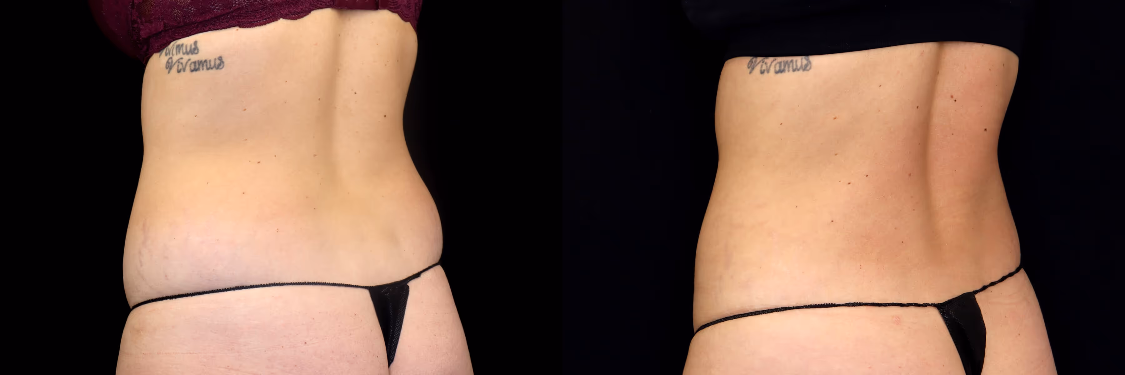 Before And After Patient Image