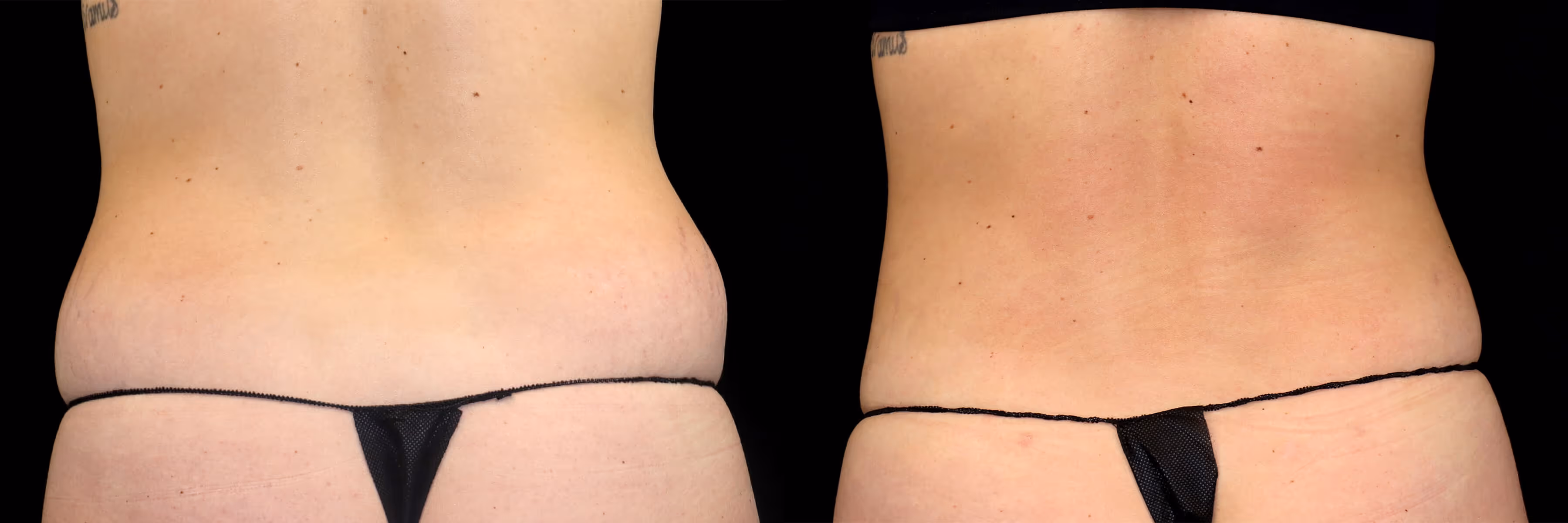 Before And After Patient Image