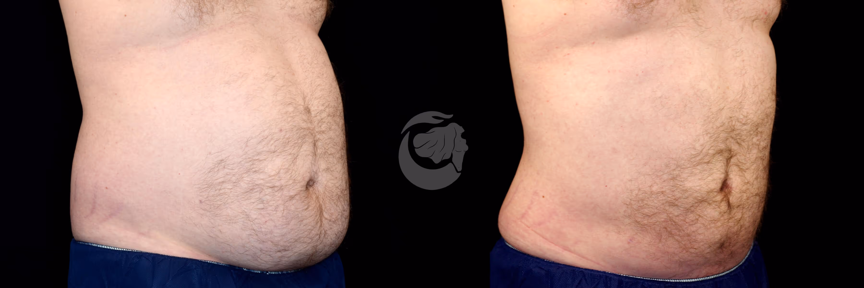 Before And After Patient Image