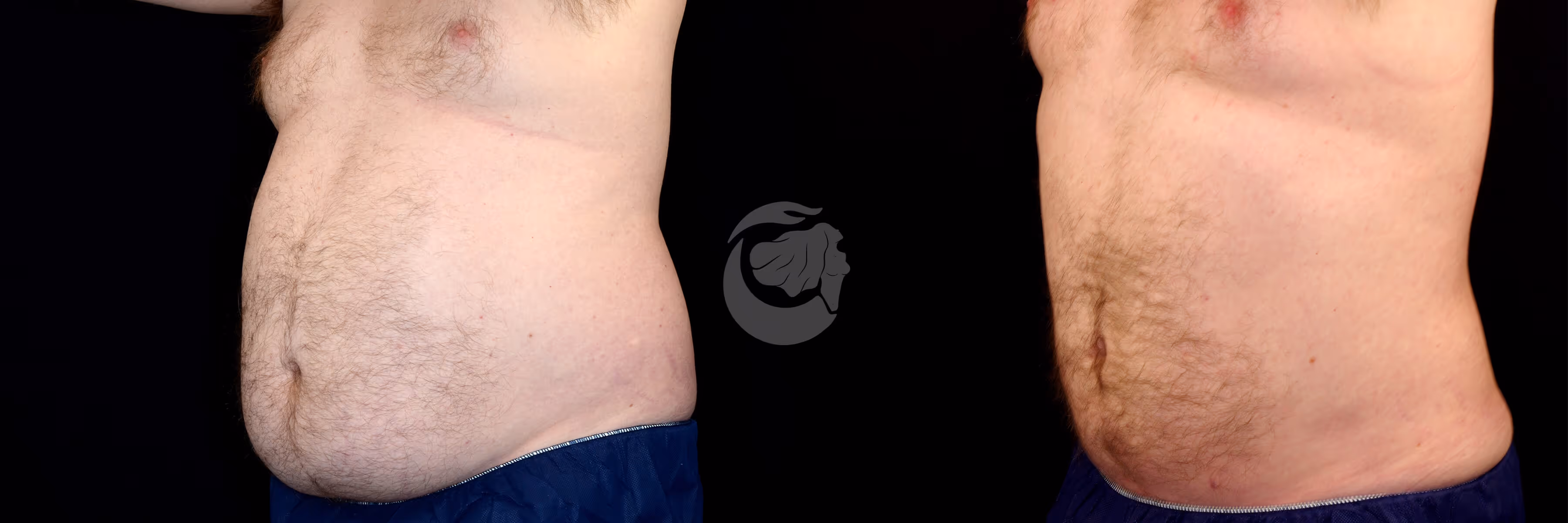 Before And After Patient Image
