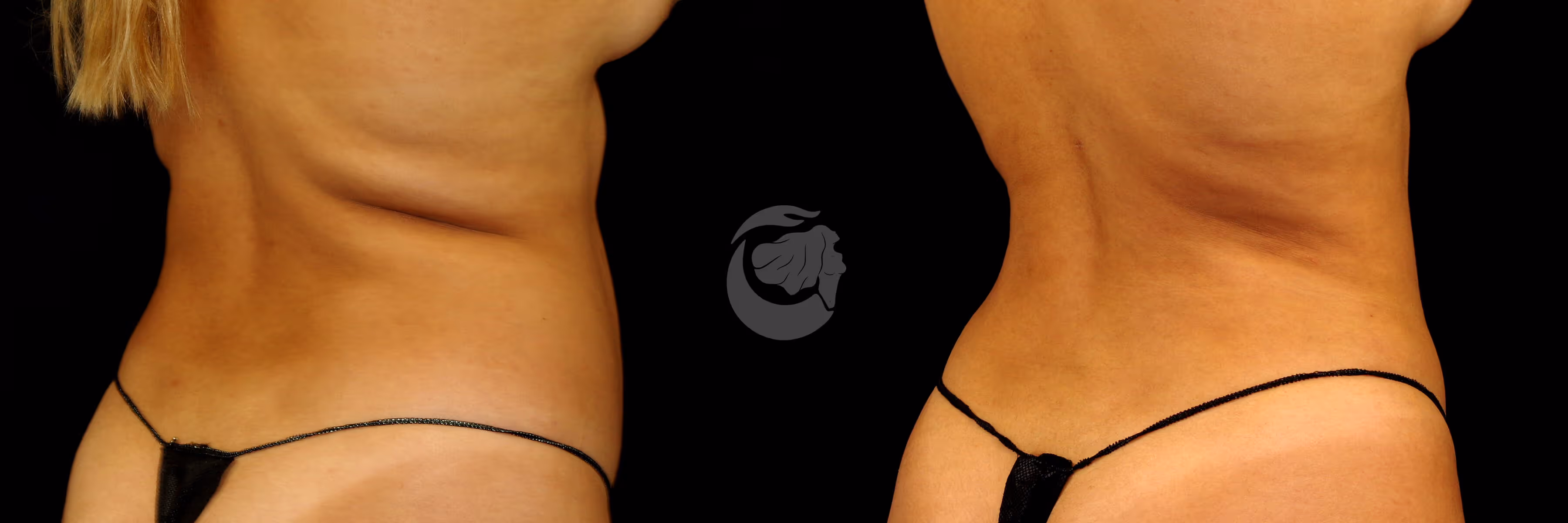 Before And After Patient Image