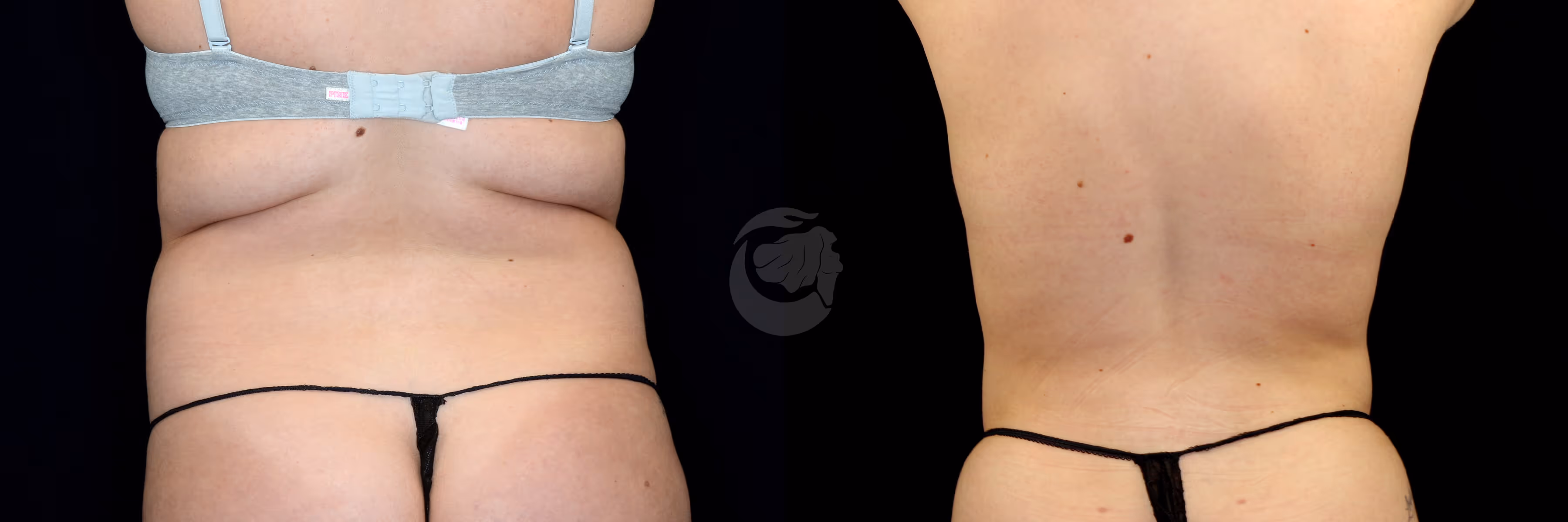 Before And After Patient Image