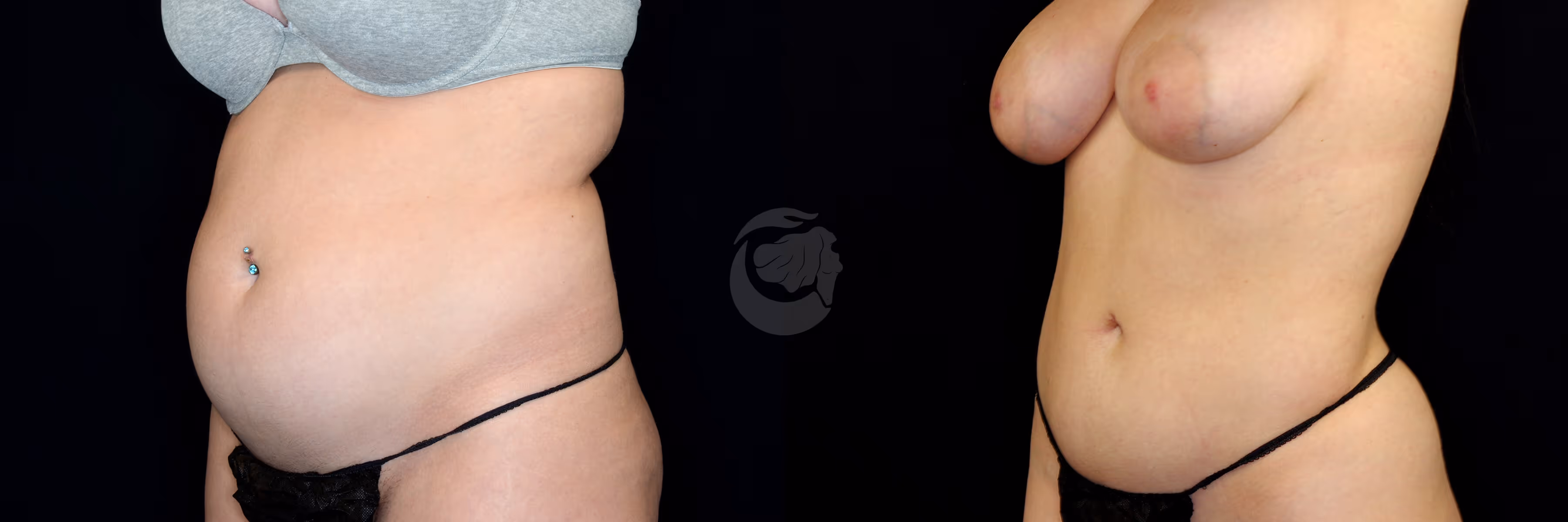 Before And After Patient Image