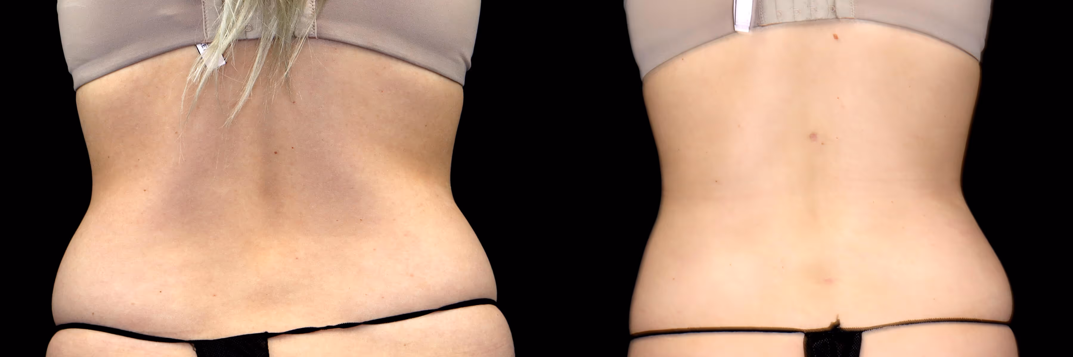 Before And After Patient Image