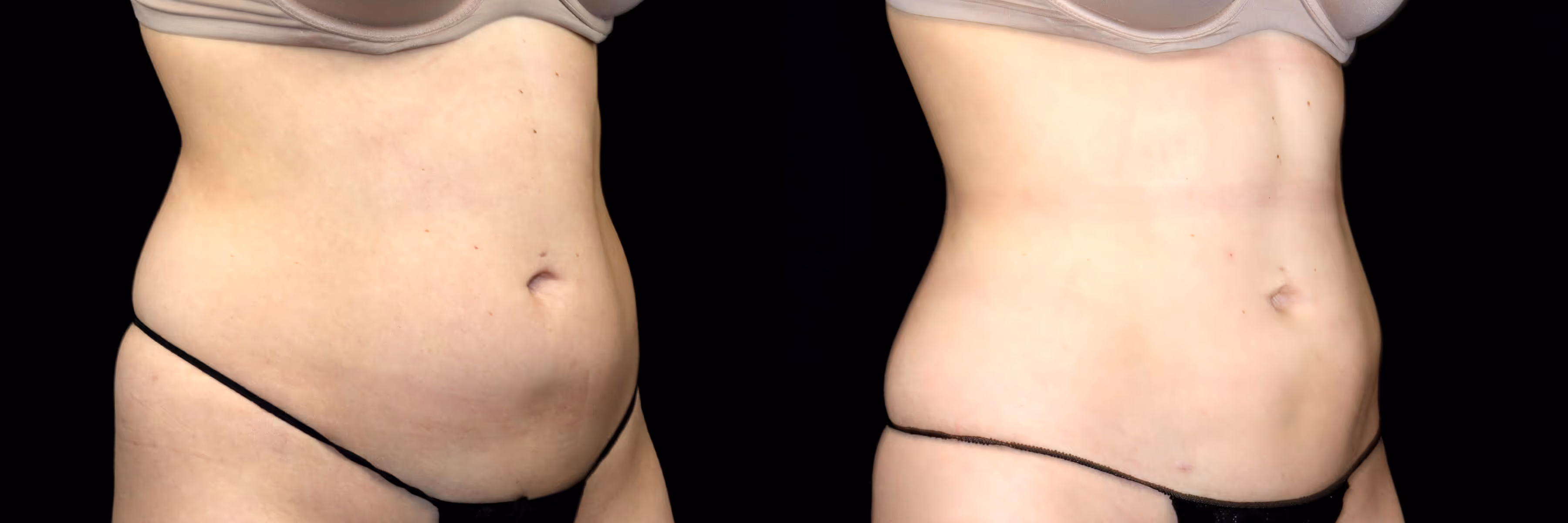 Before And After Patient Image