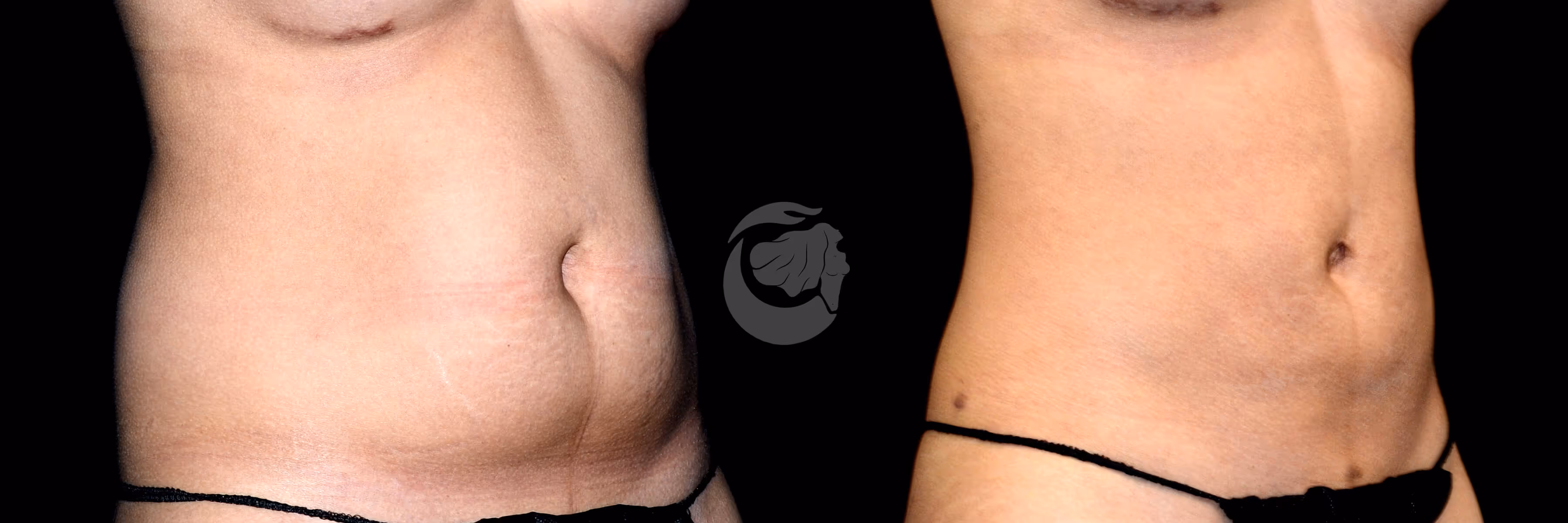Before And After Patient Image