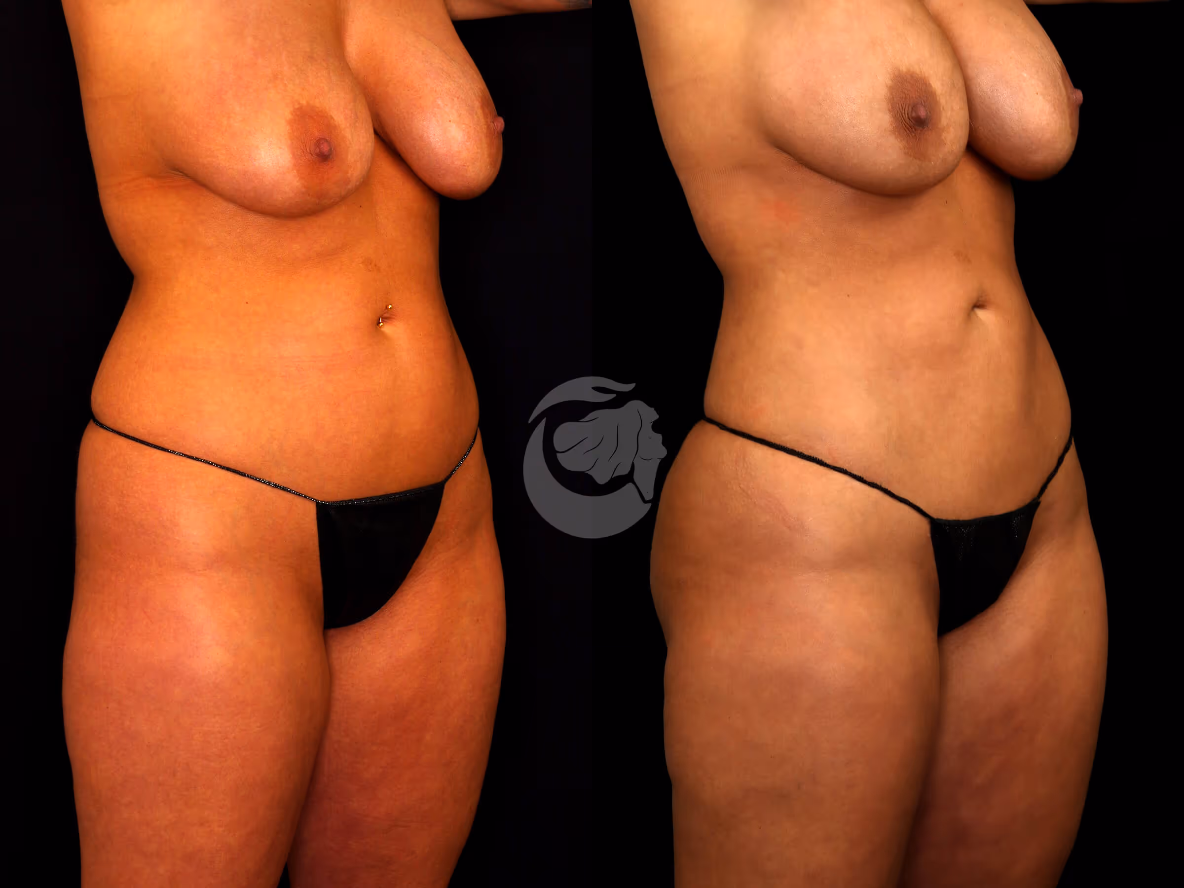 Before And After Patient Image