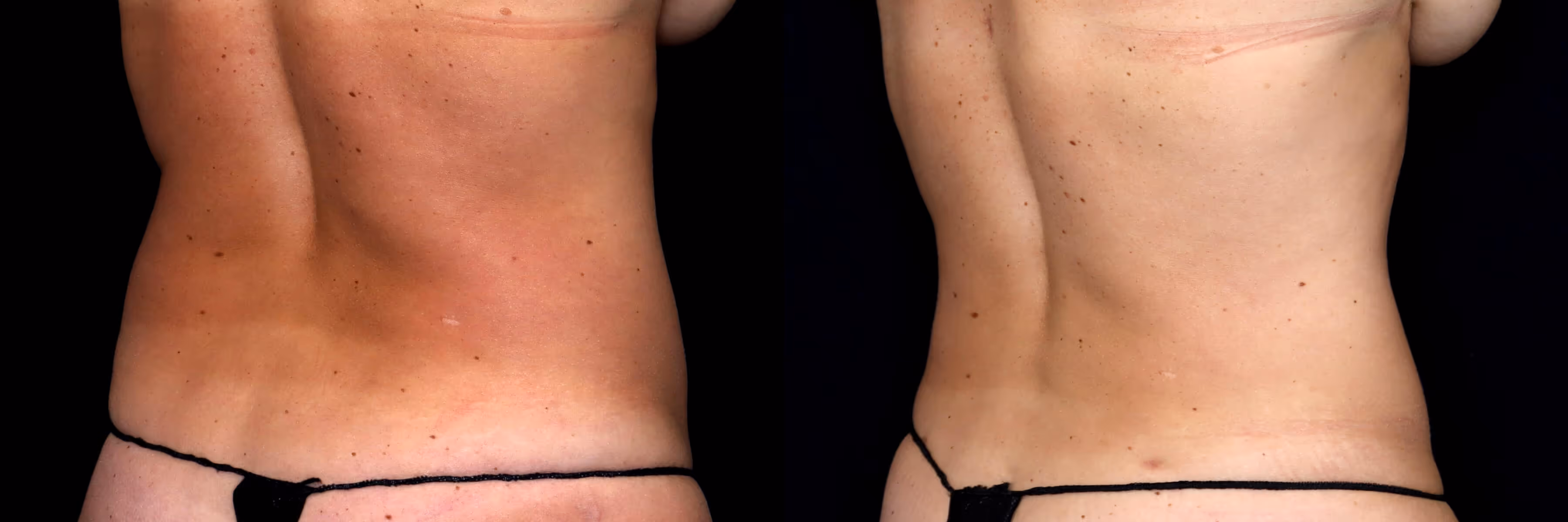 Before And After Patient Image
