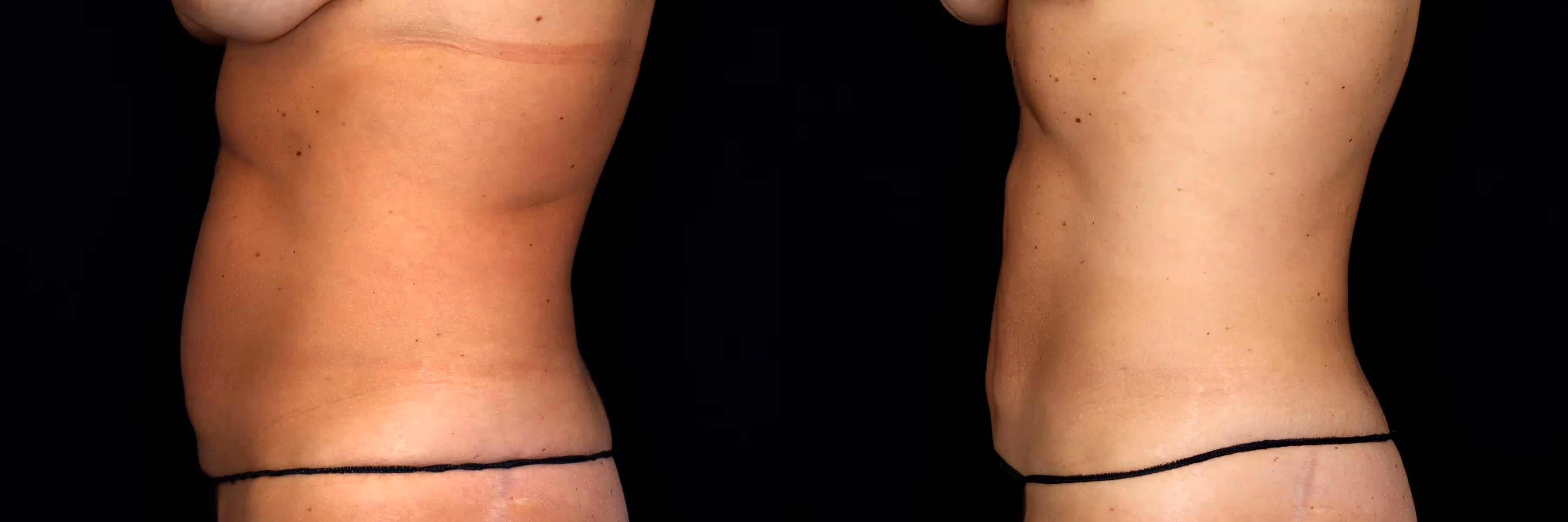Before And After Patient Image