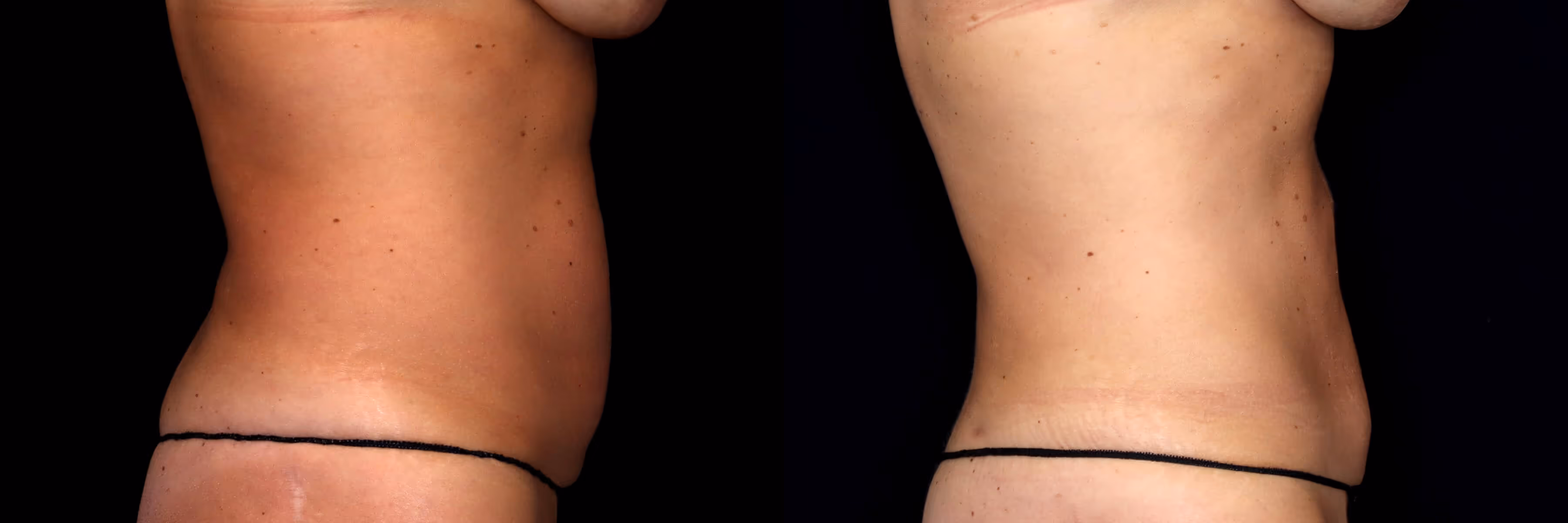 Before And After Patient Image