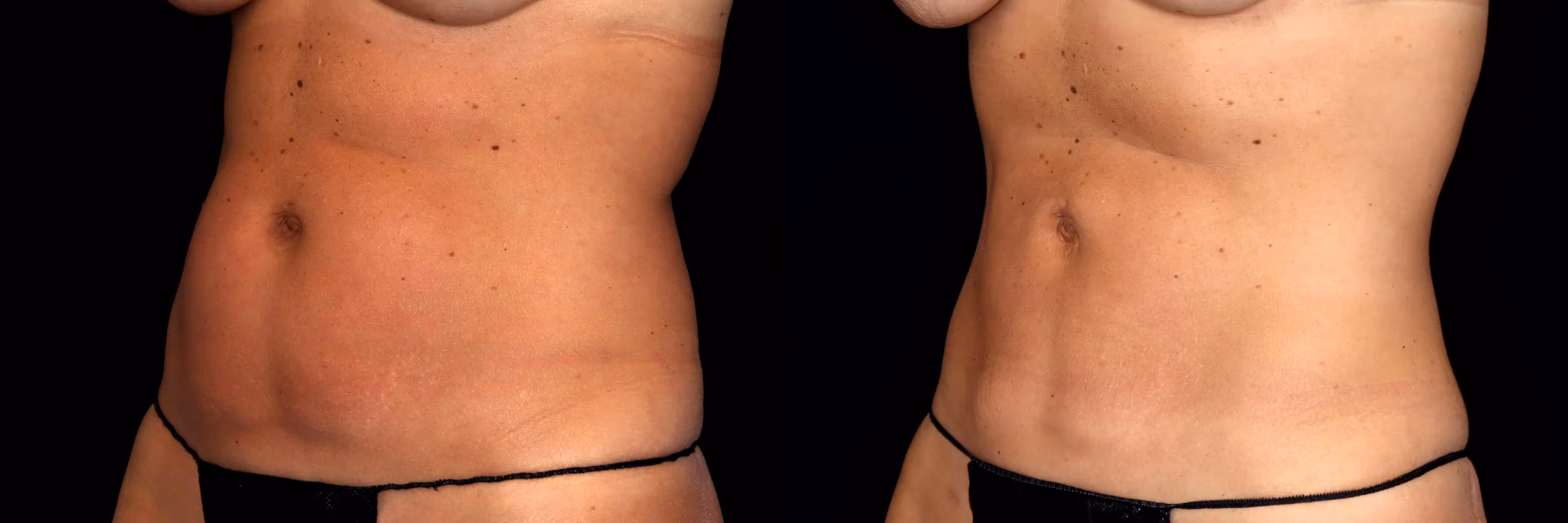 Before And After Patient Image