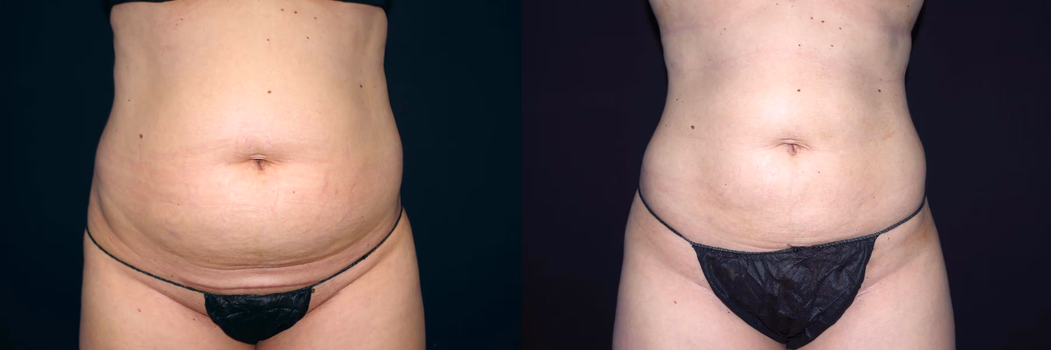 Before And After Patient Image