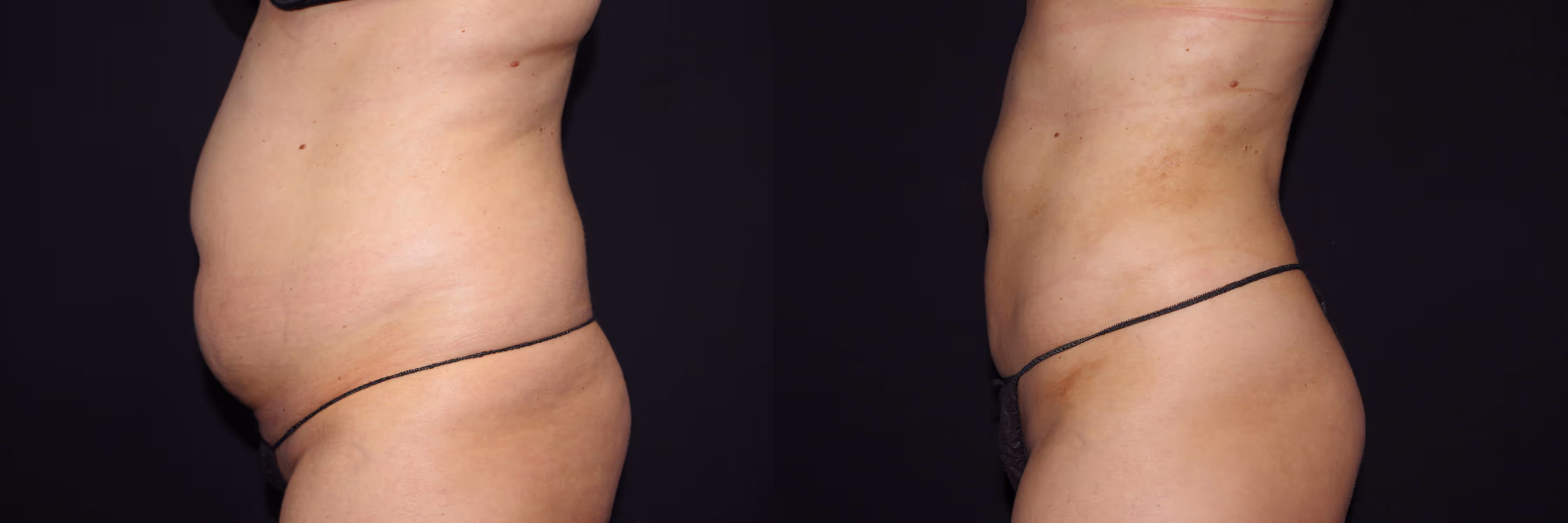 Before And After Patient Image