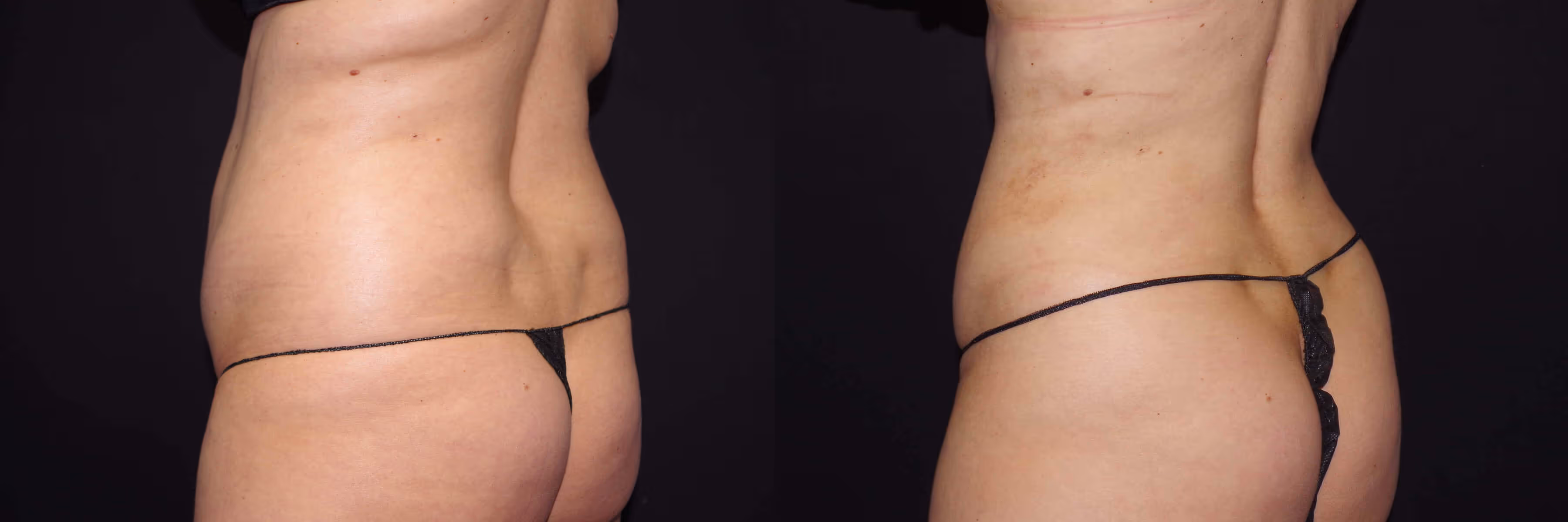 Before And After Patient Image