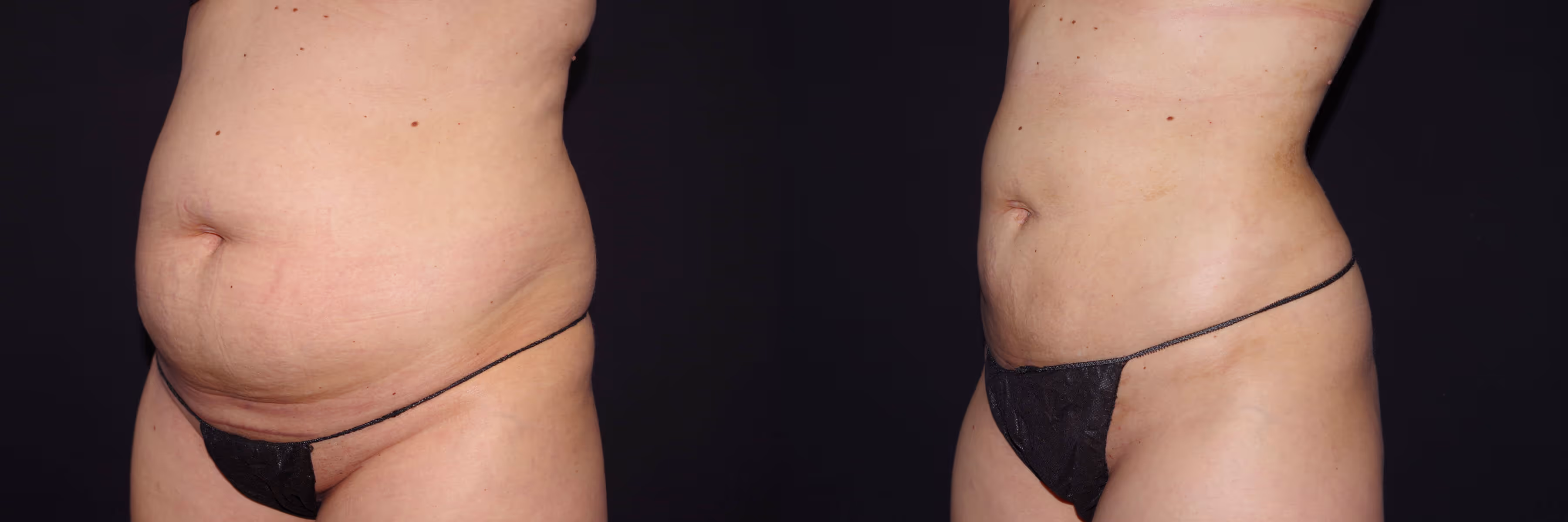 Before And After Patient Image