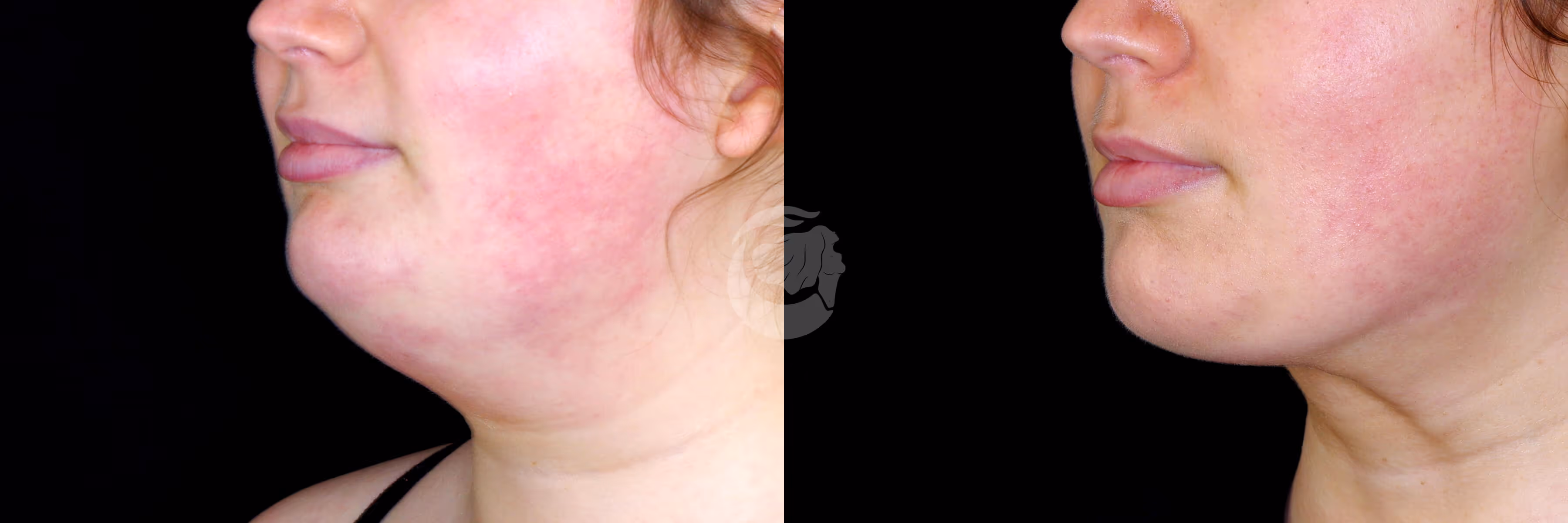 Before And After Patient Image