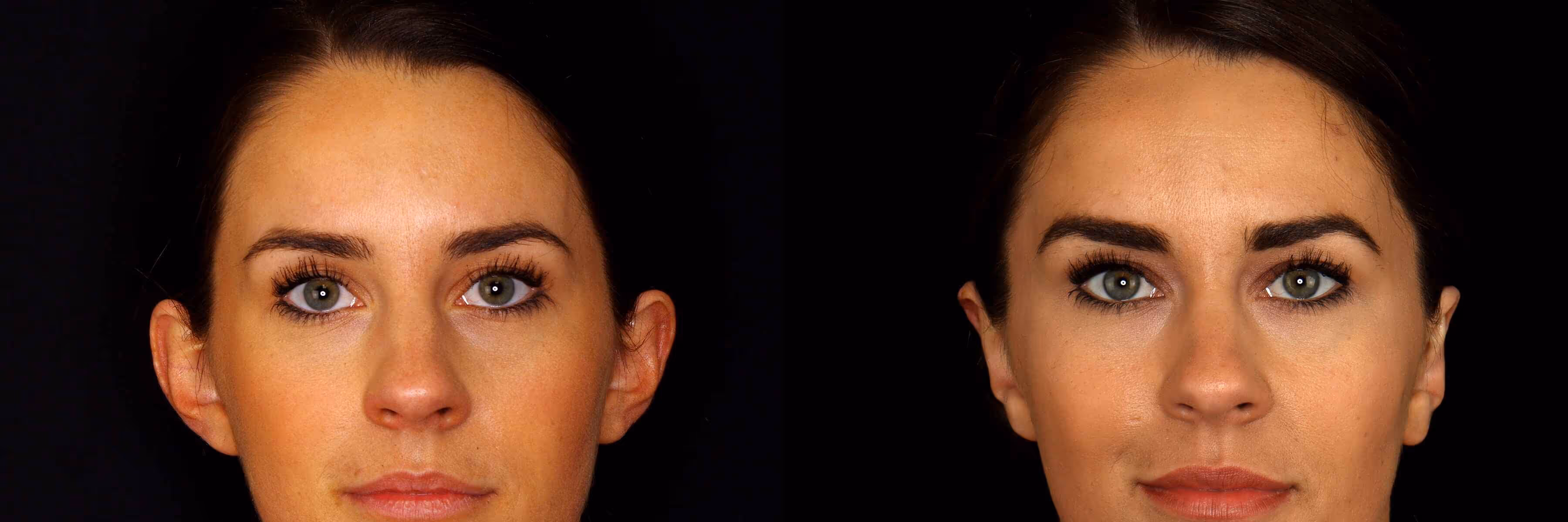 Before And After Patient Image