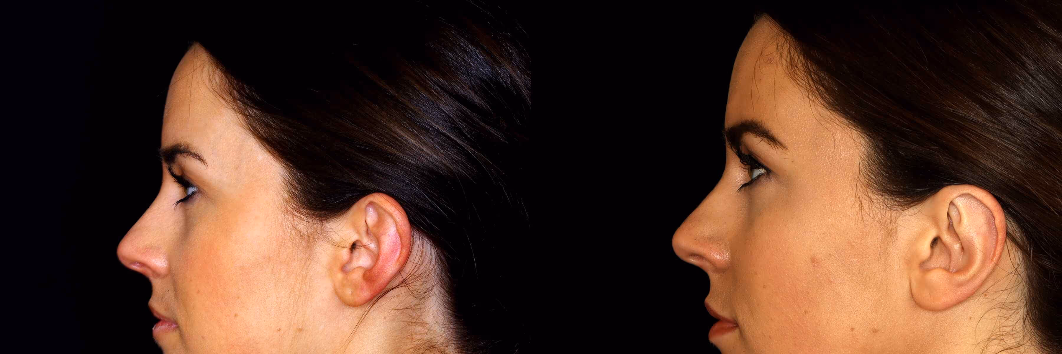 Before And After Patient Image