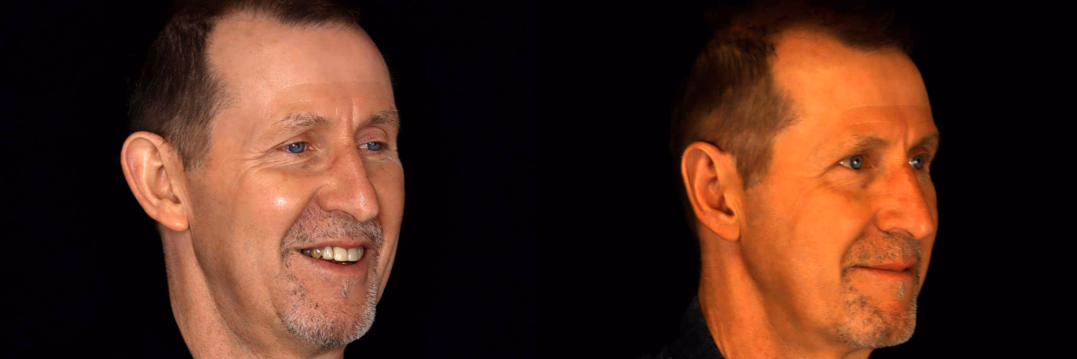 Before And After Patient Image