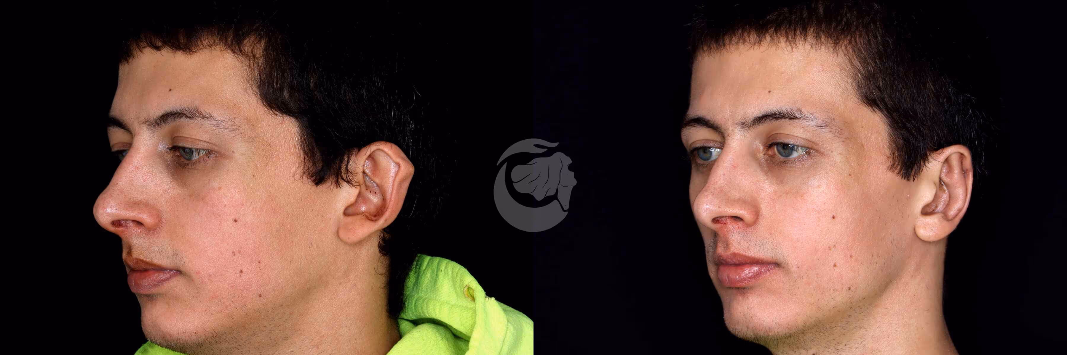 Before And After Patient Image