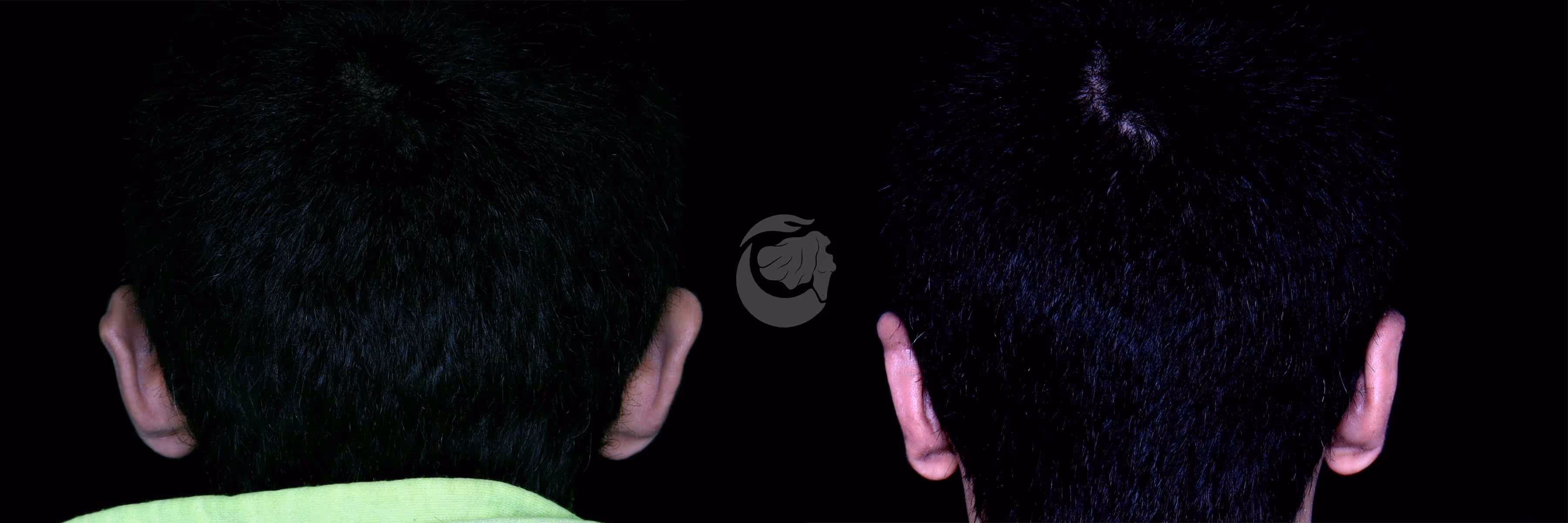 Before And After Patient Image