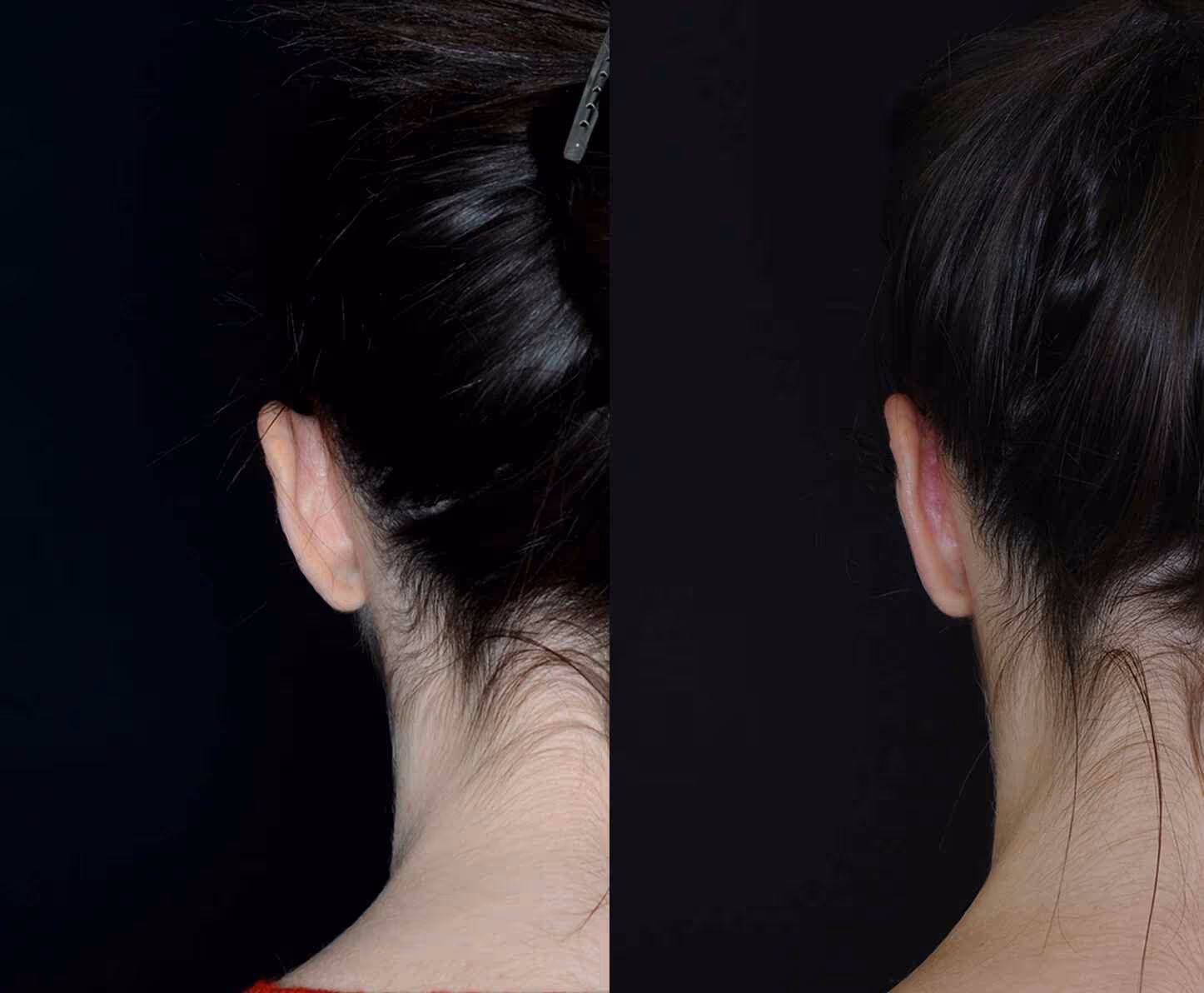 Before And After Patient Image