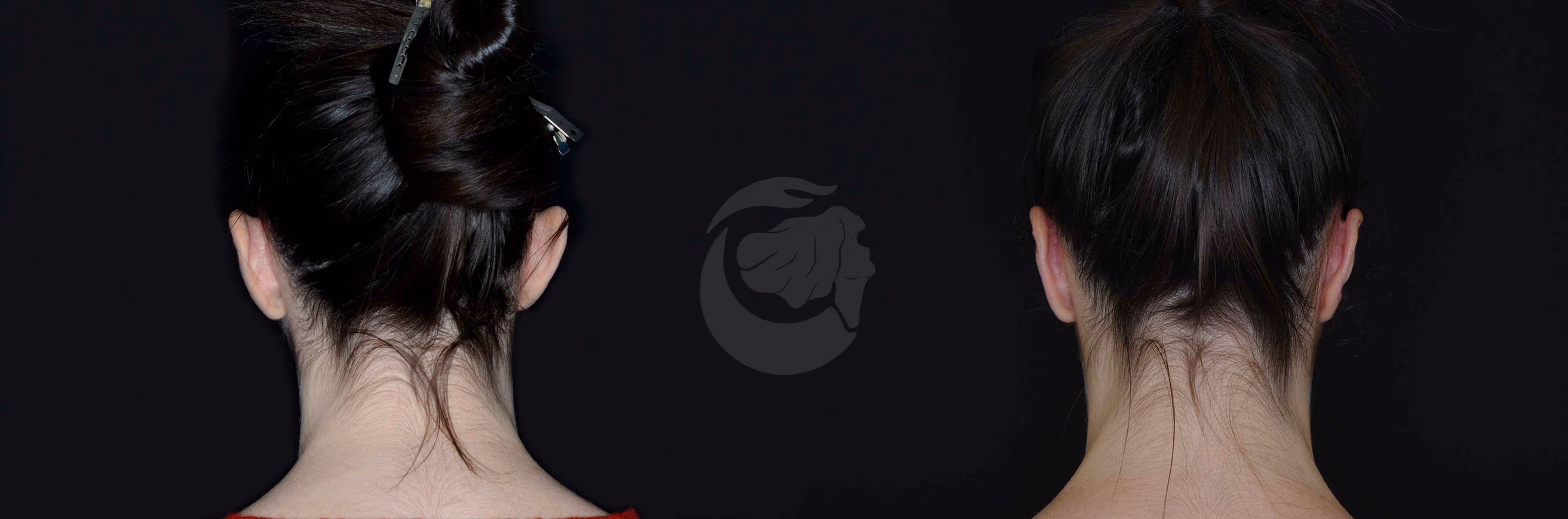 Before And After Patient Image