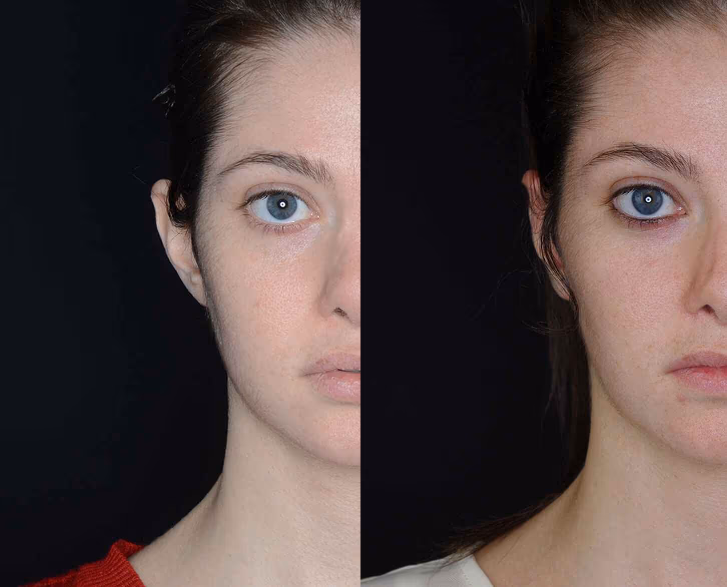 Before And After Patient Image