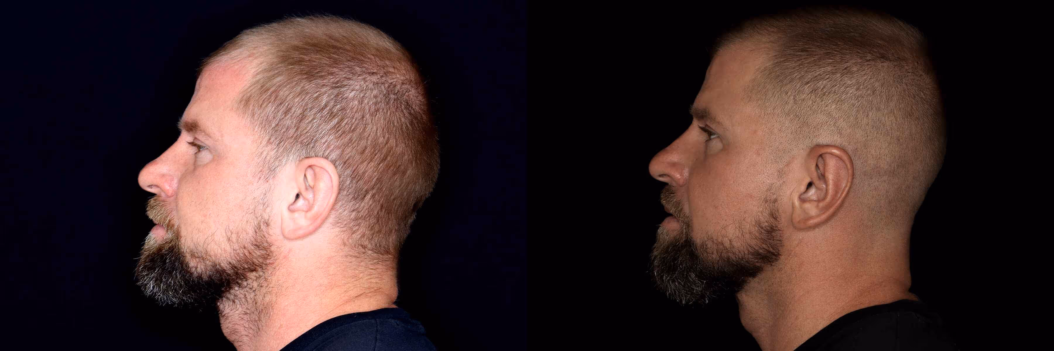 Before And After Patient Image