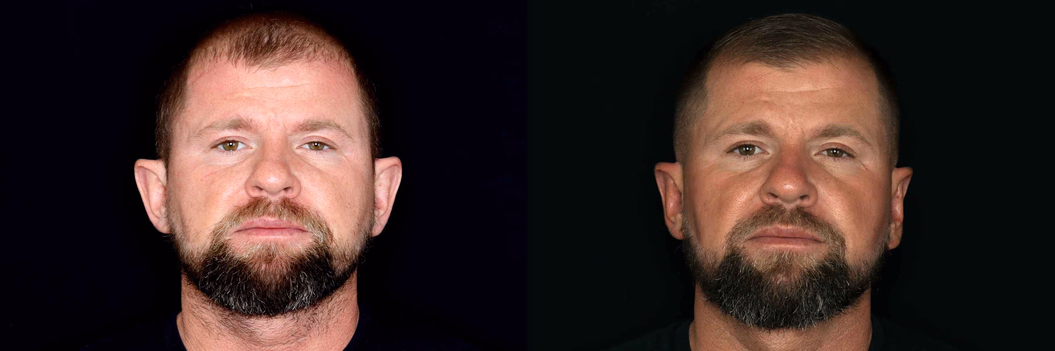 Before And After Patient Image