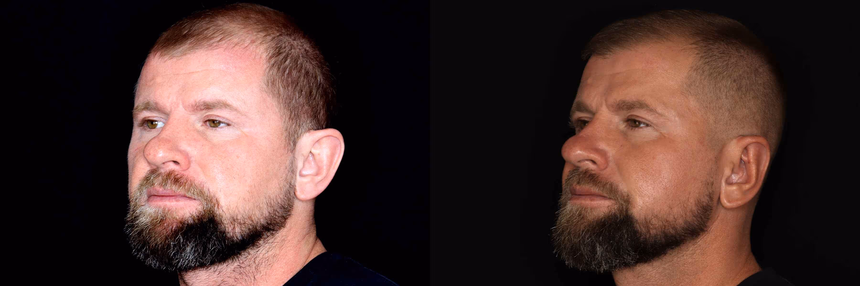 Before And After Patient Image