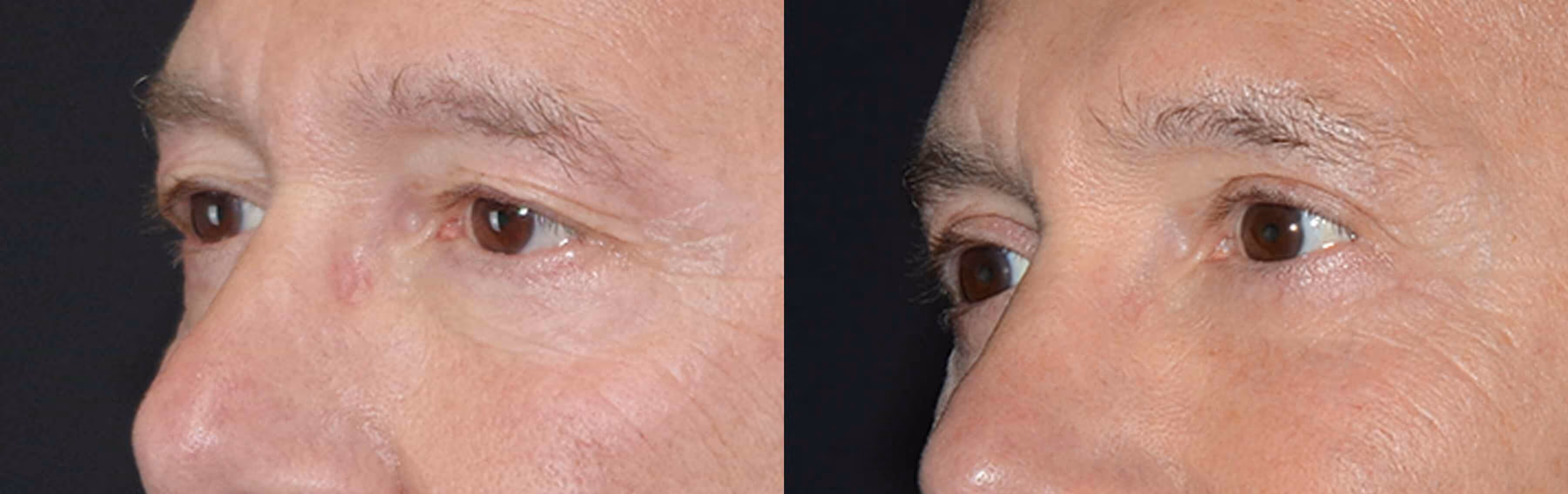 Before And After Patient Image