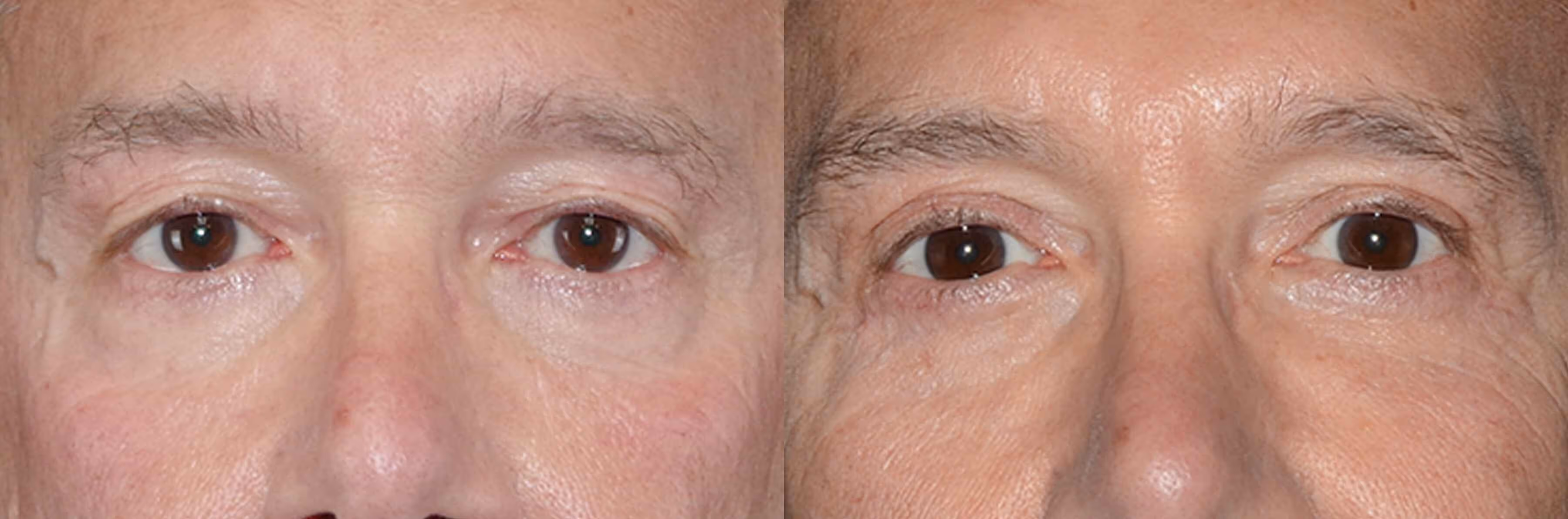 Before And After Patient Image