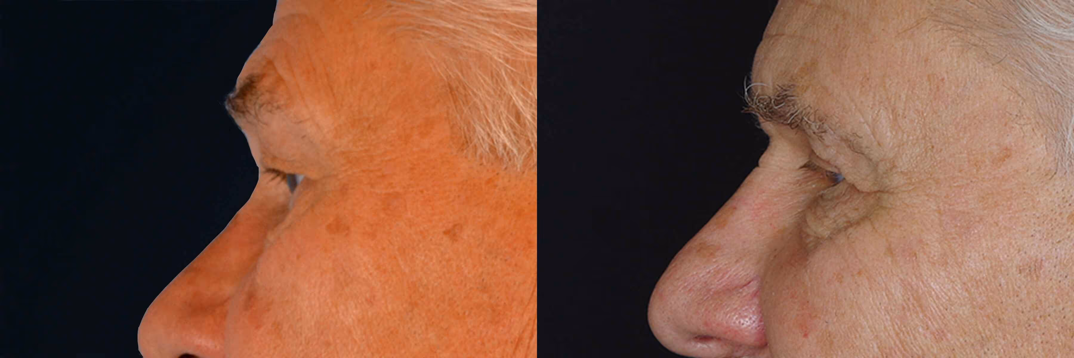 Before And After Patient Image