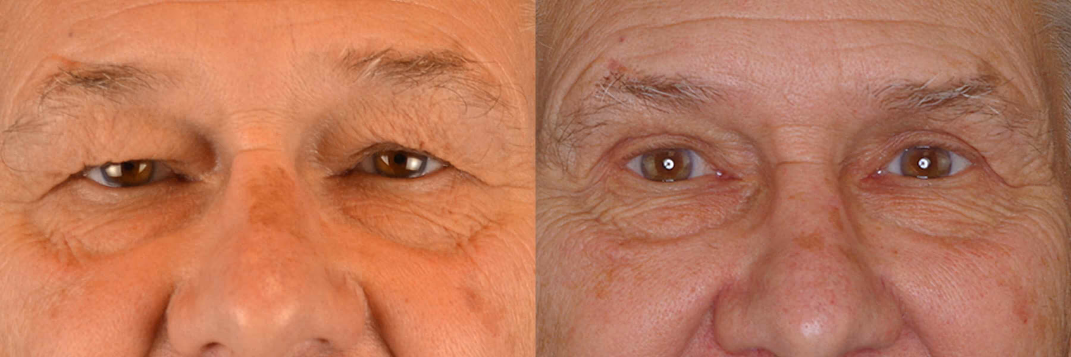 Before And After Patient Image