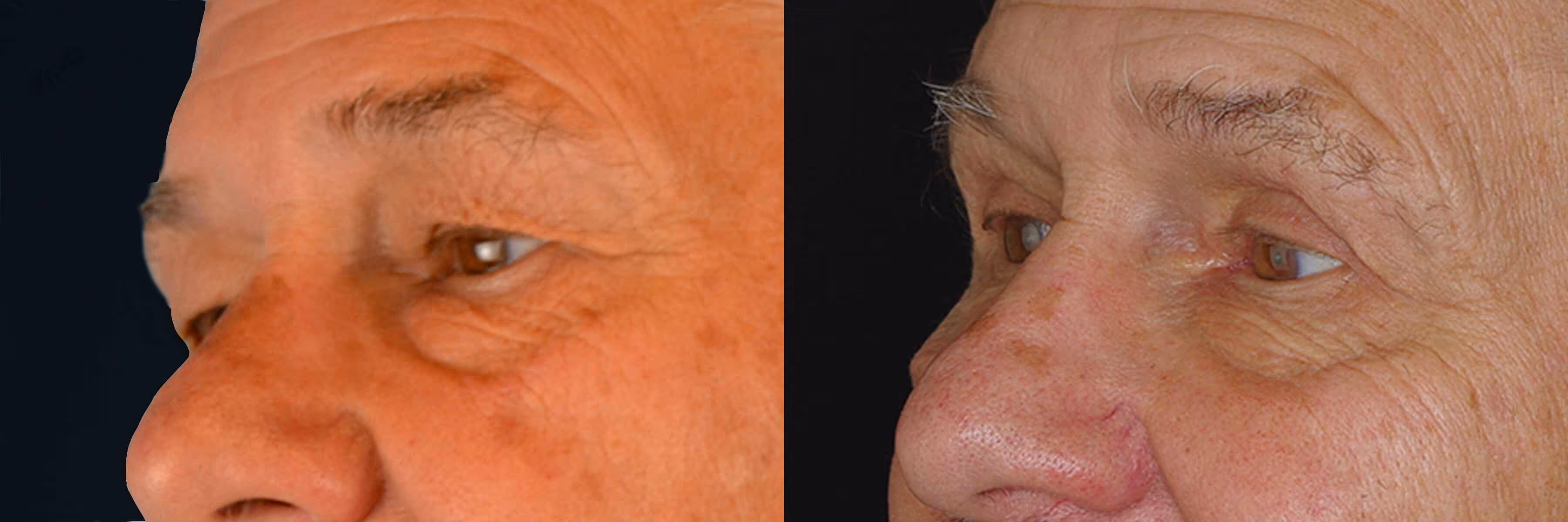 Before And After Patient Image