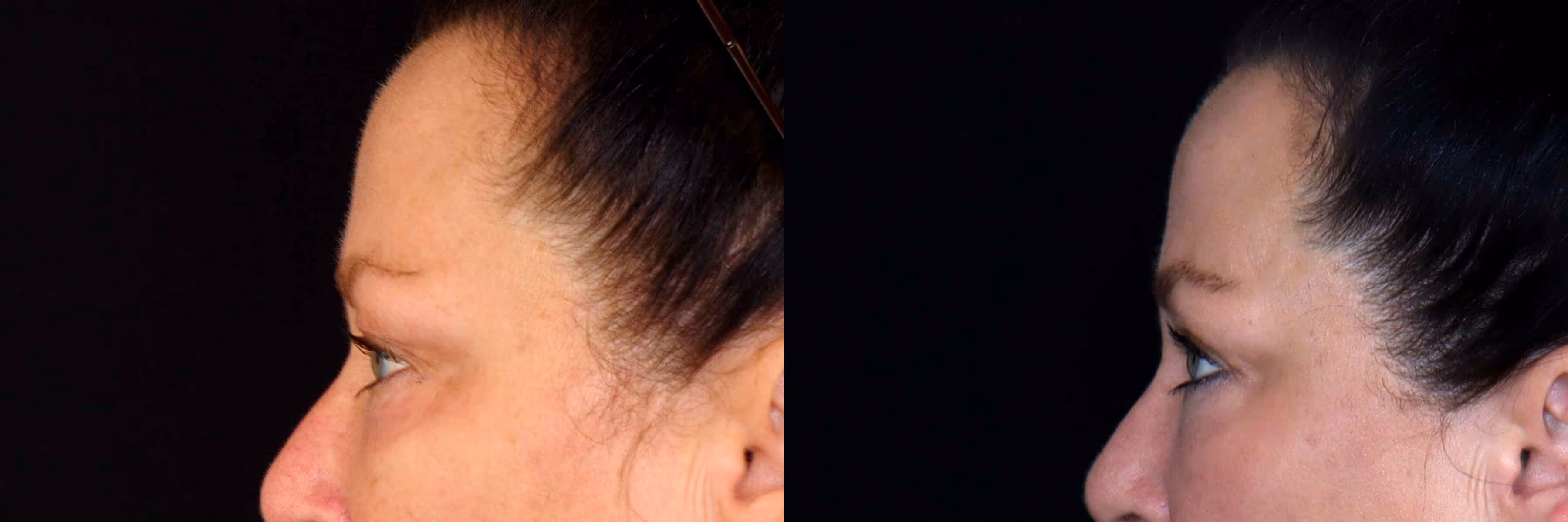 Before And After Patient Image