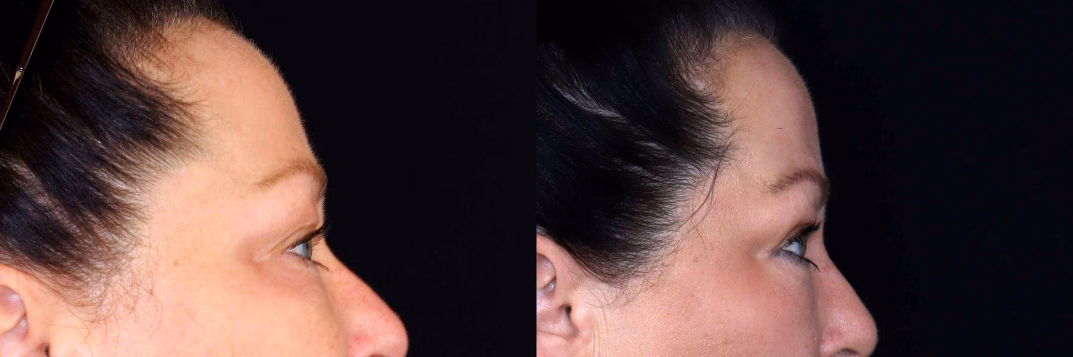 Before And After Patient Image