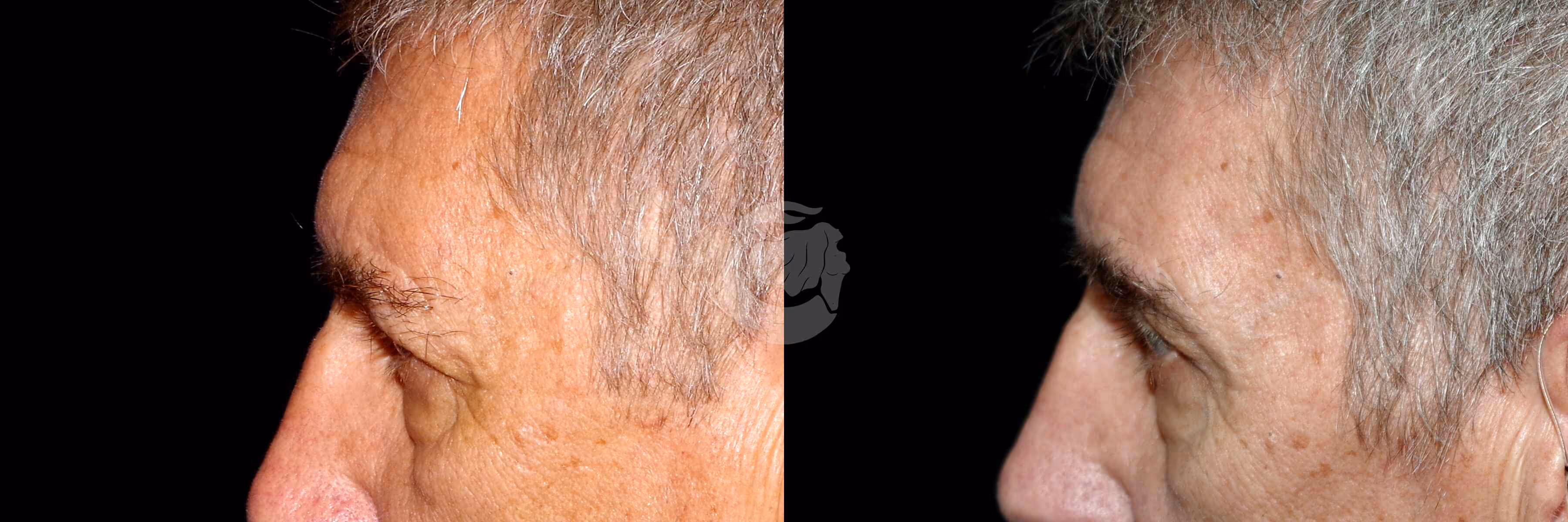 Before And After Patient Image