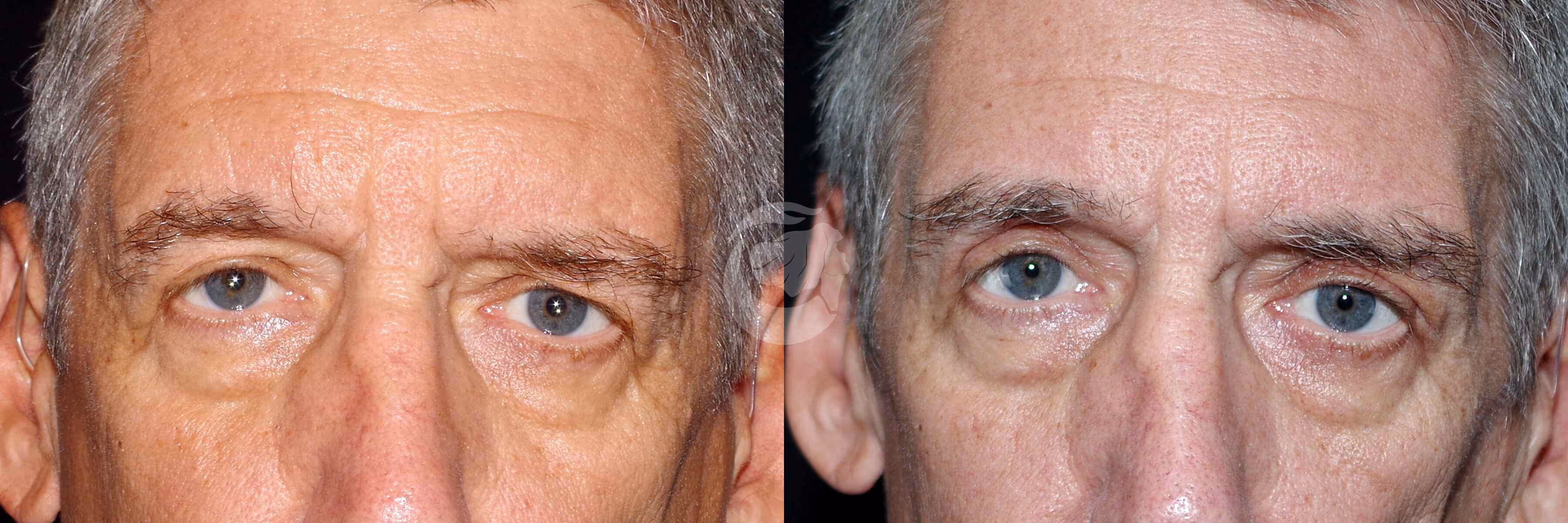 Before And After Patient Image