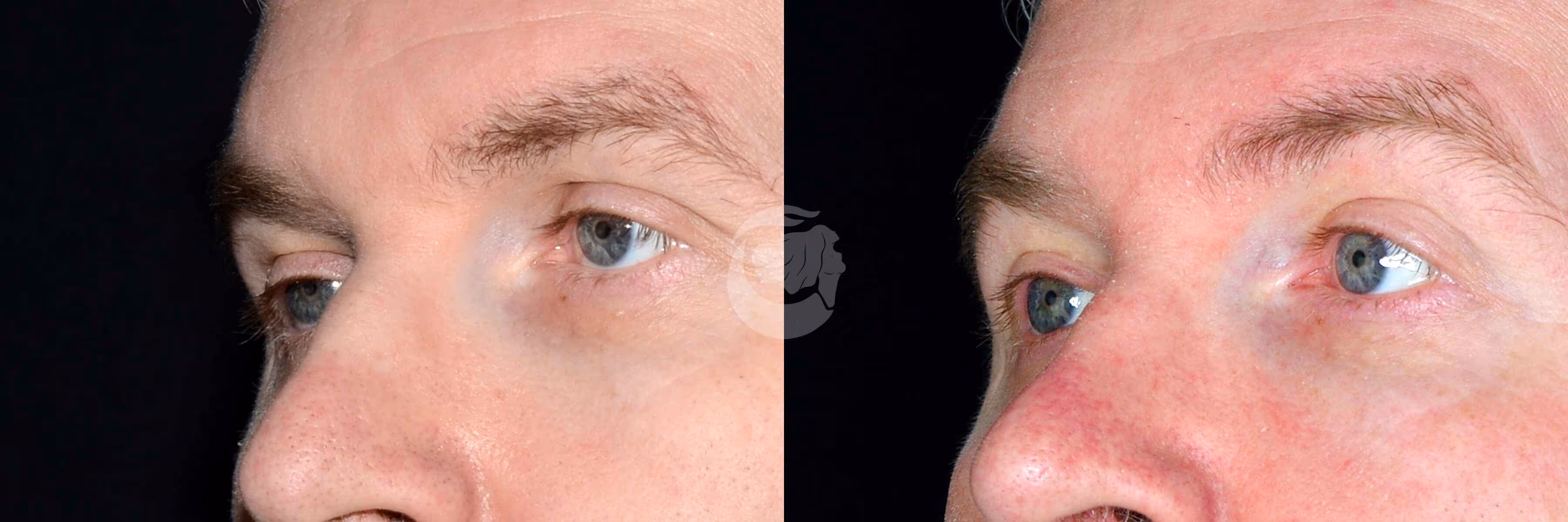 Before And After Patient Image