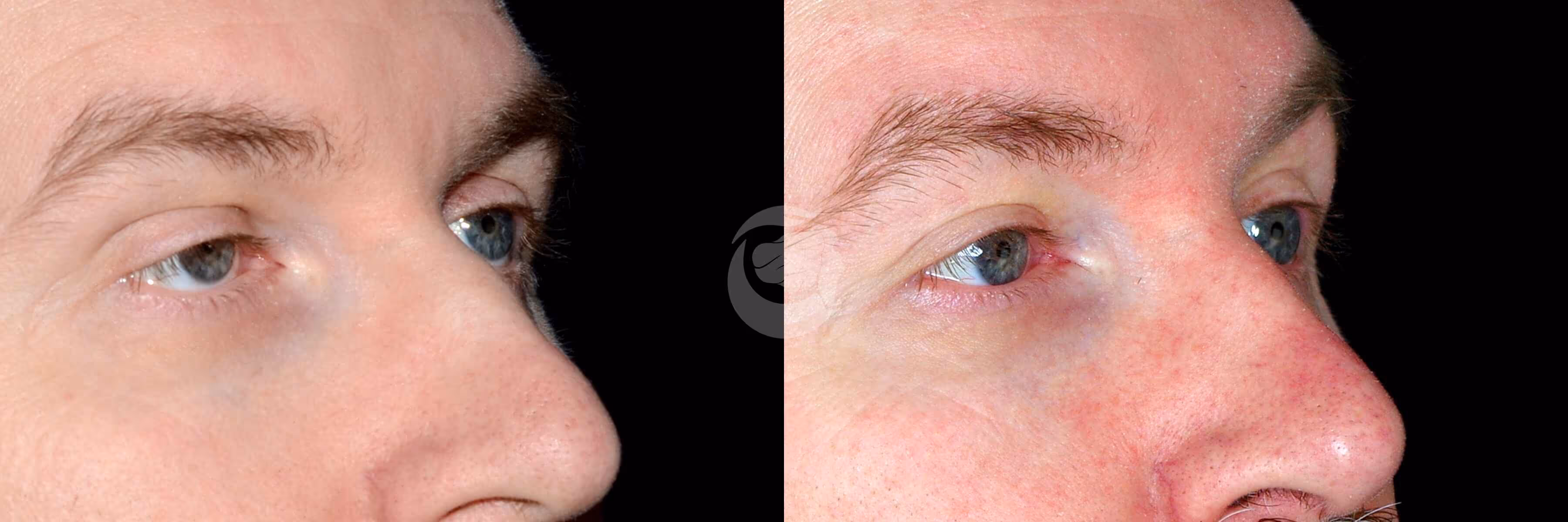 Before And After Patient Image