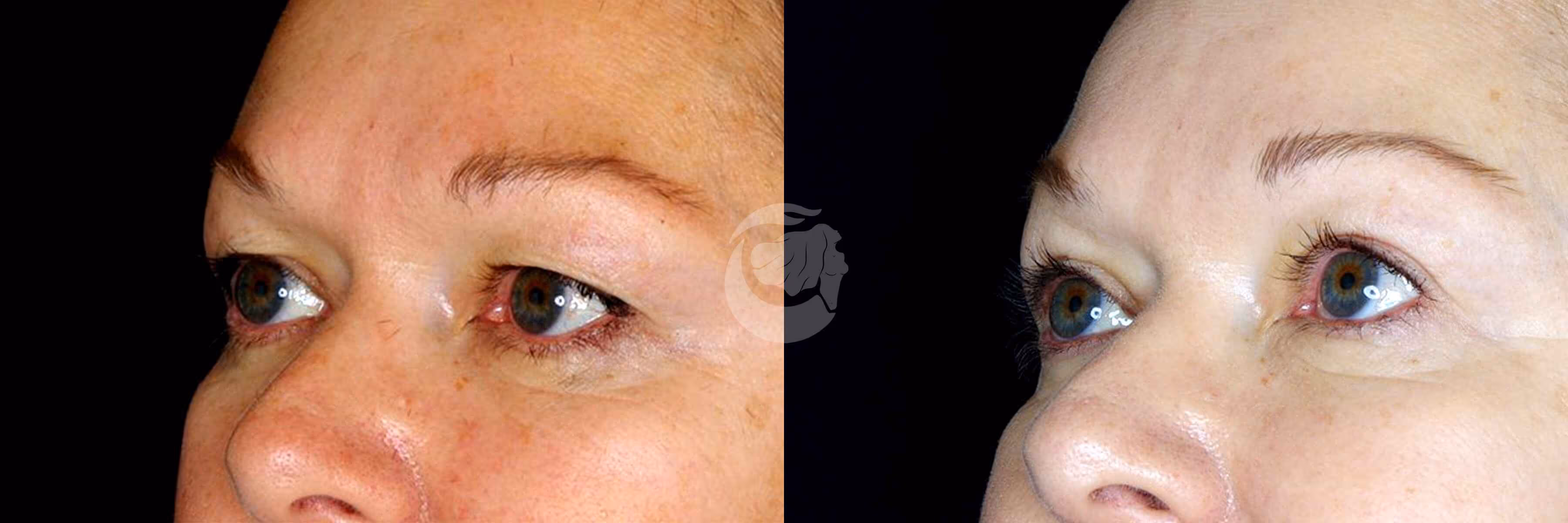 Before And After Patient Image