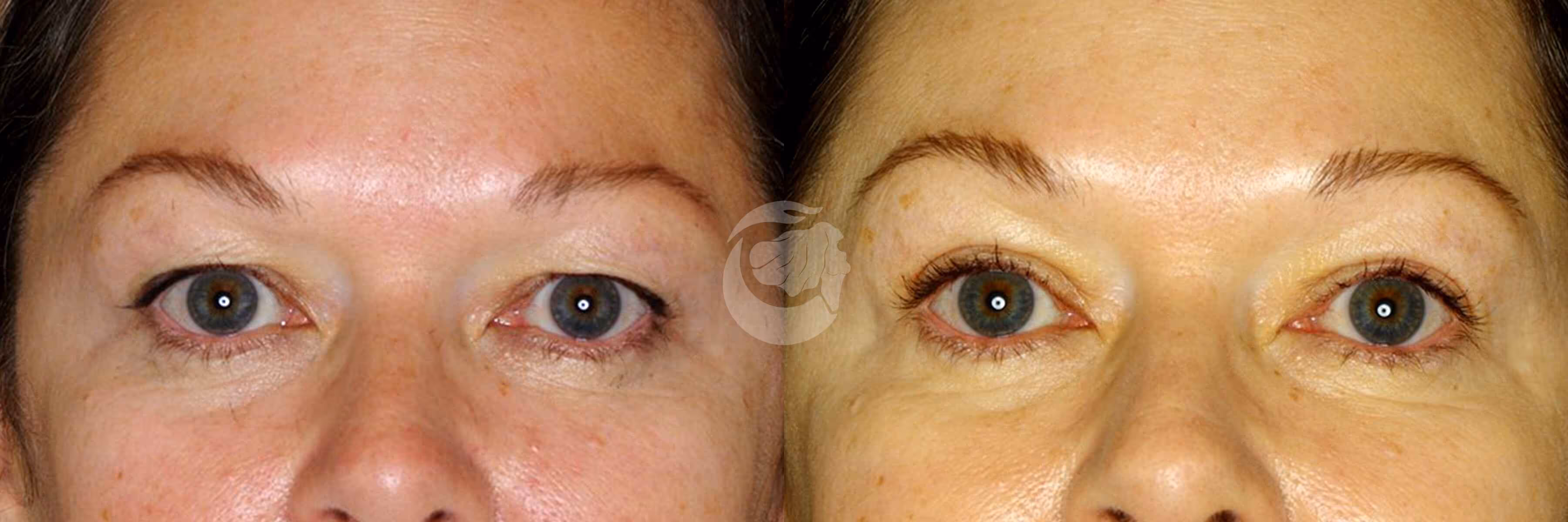 Before And After Patient Image