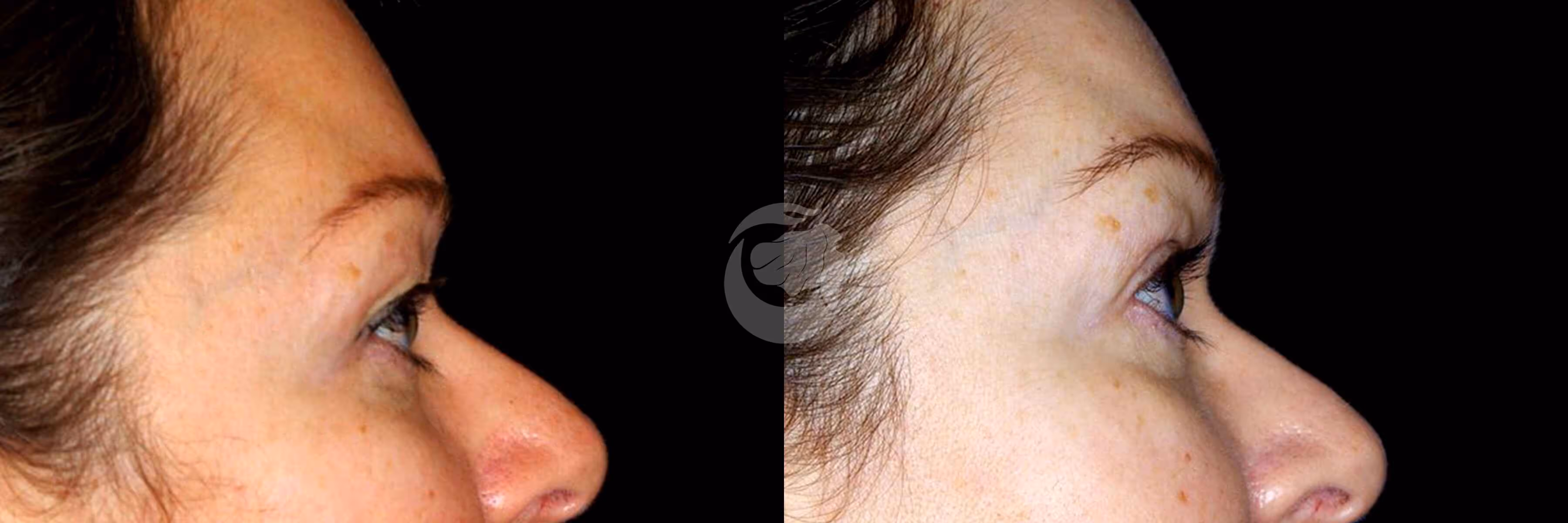 Before And After Patient Image