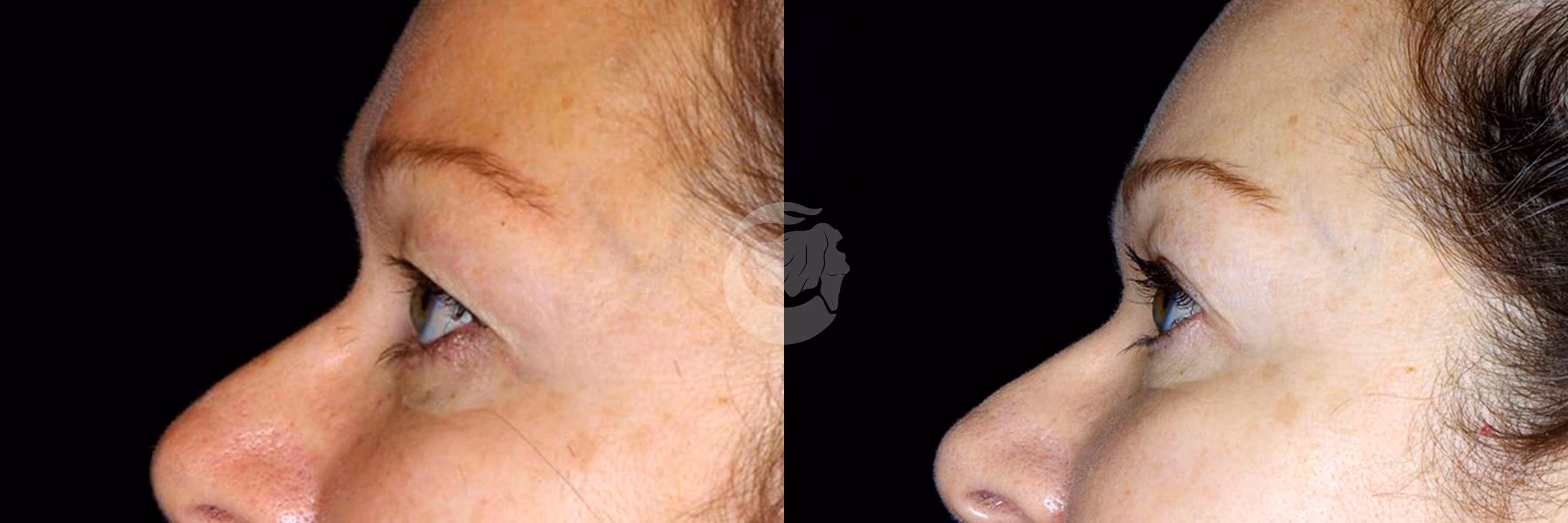 Before And After Patient Image