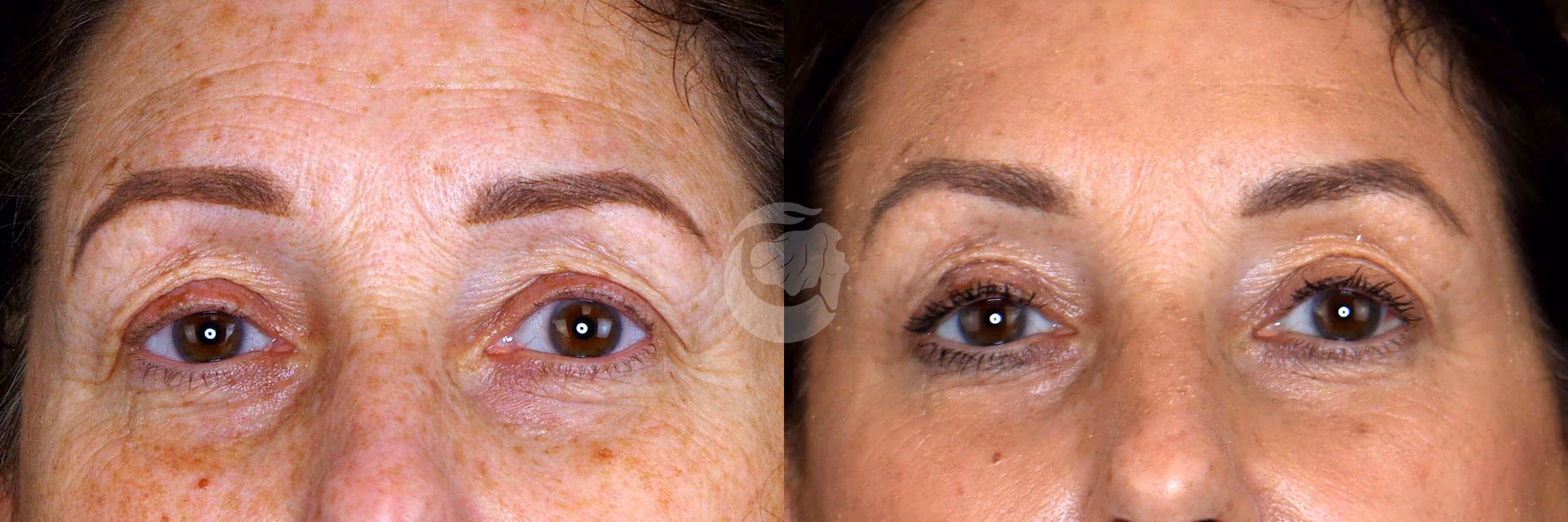 Before And After Patient Image